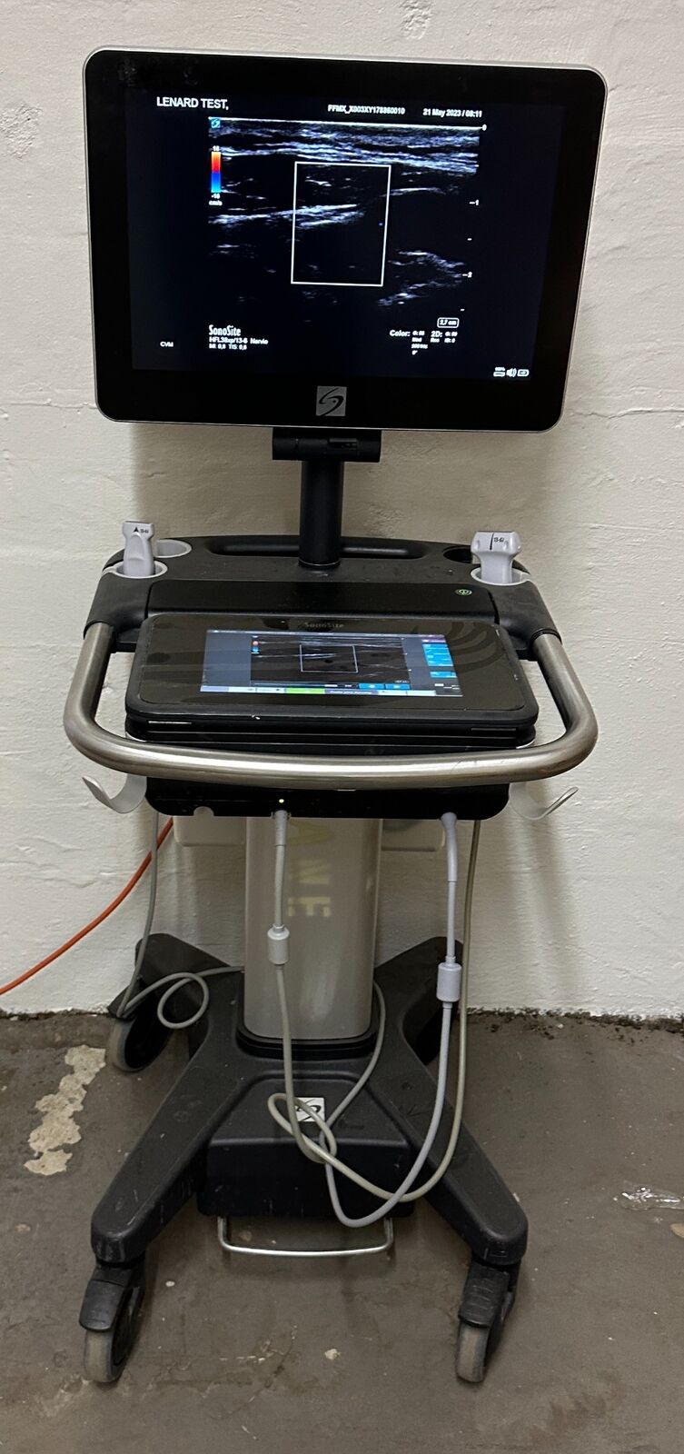 Sonosite X Porte Ultrasound & probes: P21XP, HFL38XP Refurbished, 2020 Spanish DIAGNOSTIC ULTRASOUND MACHINES FOR SALE