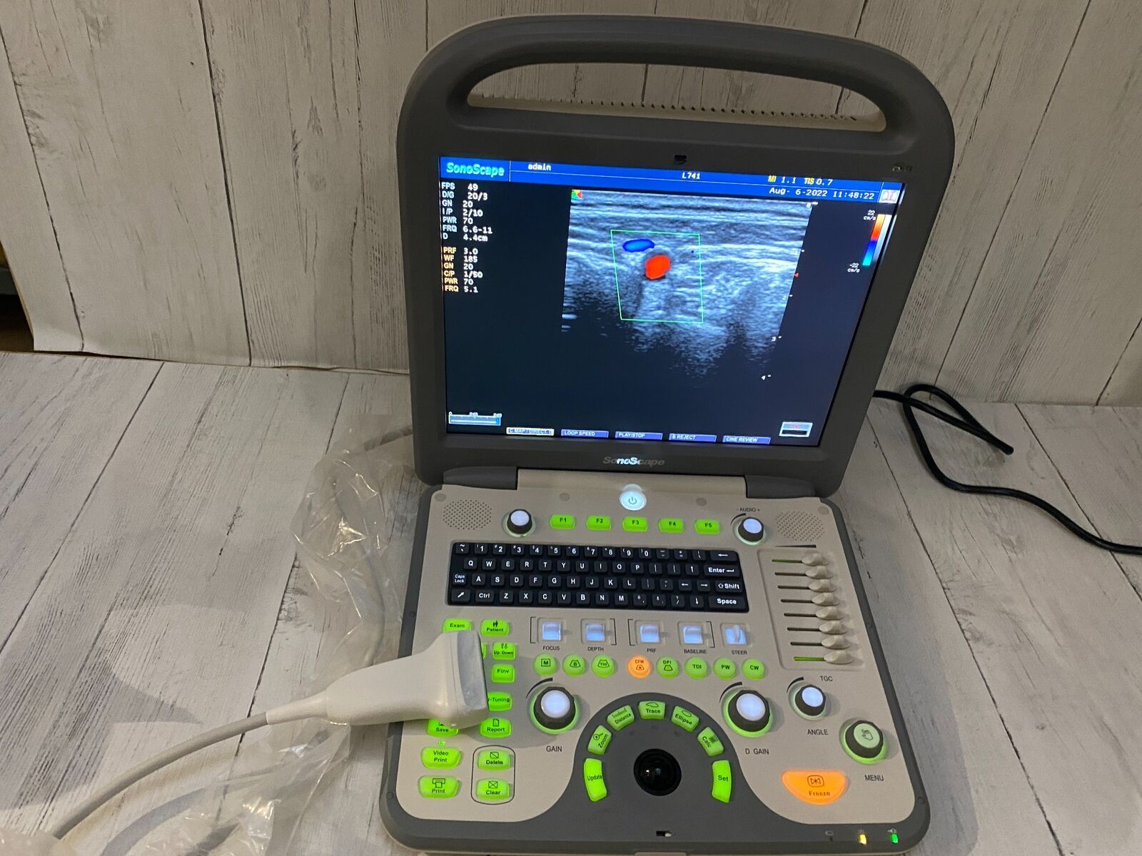 SonoScape S8 with linear array probe transducer L741 DIAGNOSTIC ULTRASOUND MACHINES FOR SALE