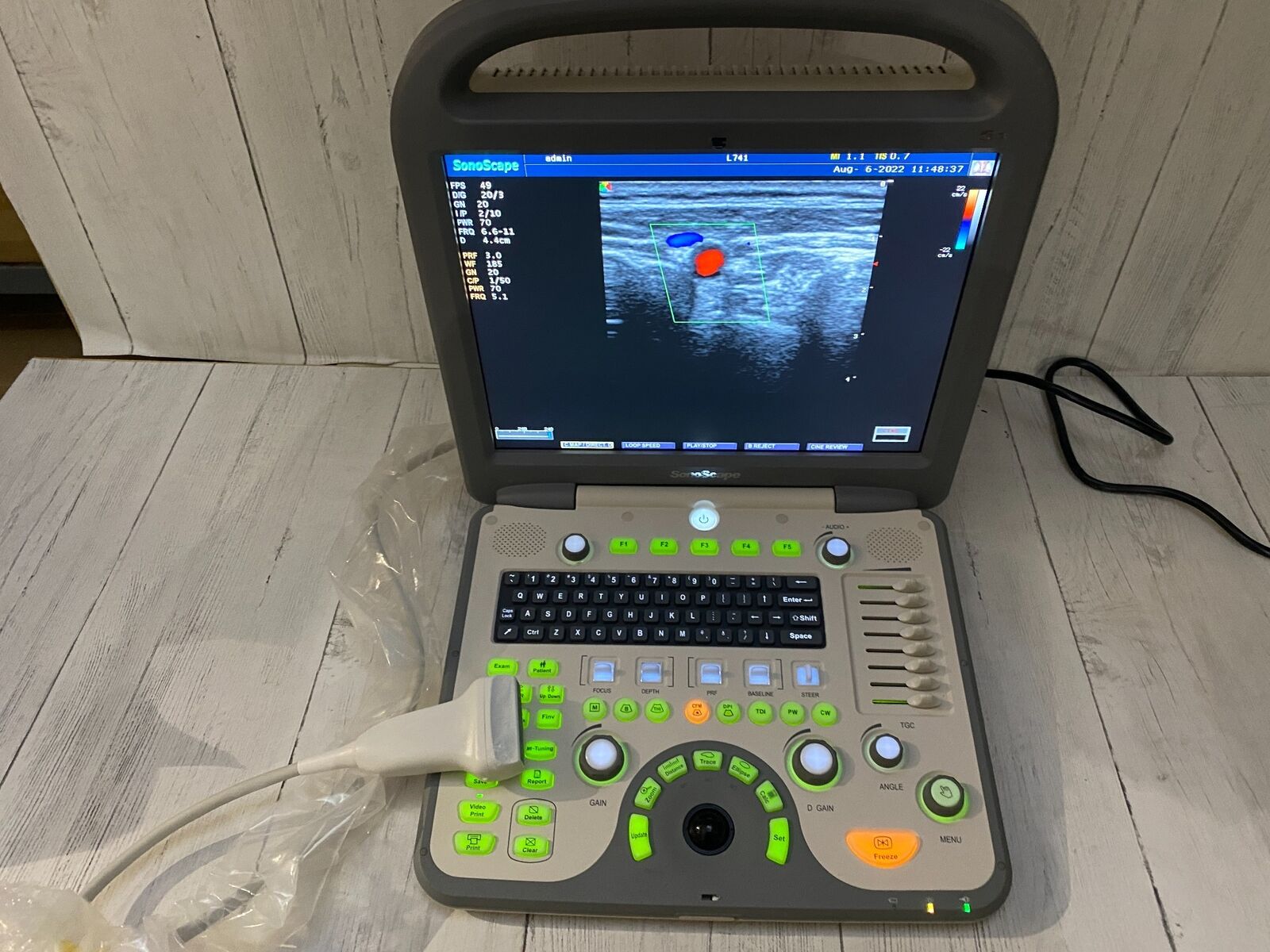 SonoScape S8 with linear array probe transducer L741 DIAGNOSTIC ULTRASOUND MACHINES FOR SALE