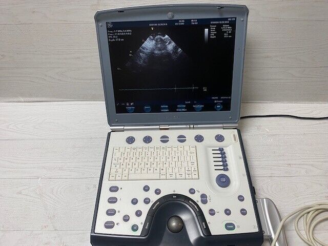 GE Vivid I Color Doppler Ultrasound Scanner, with 3s-RS cardiac Probe DIAGNOSTIC ULTRASOUND MACHINES FOR SALE