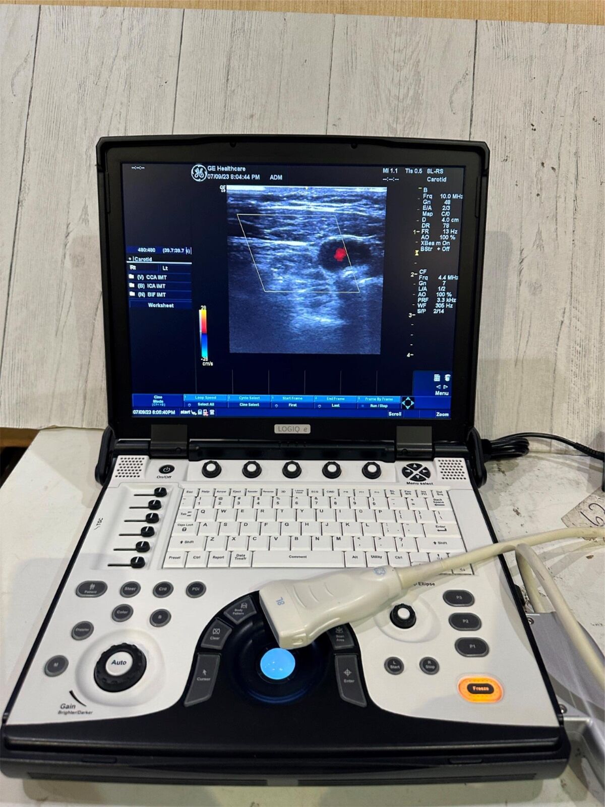 GE LOGIQ E Next Generation Ultrasound BT12 DOM 2012 DIAGNOSTIC ULTRASOUND MACHINES FOR SALE