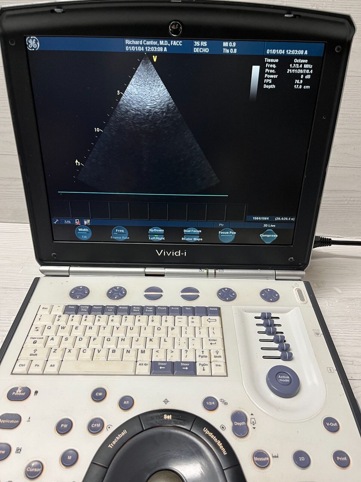 GE Vivid I Color Doppler Ultrasound Scanner, with 3s-RS cardiac & Linear L8-RS DIAGNOSTIC ULTRASOUND MACHINES FOR SALE