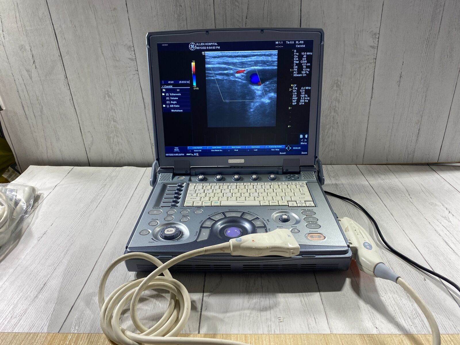 GE LogiQ E portable ultrasound DIAGNOSTIC ULTRASOUND MACHINES FOR SALE