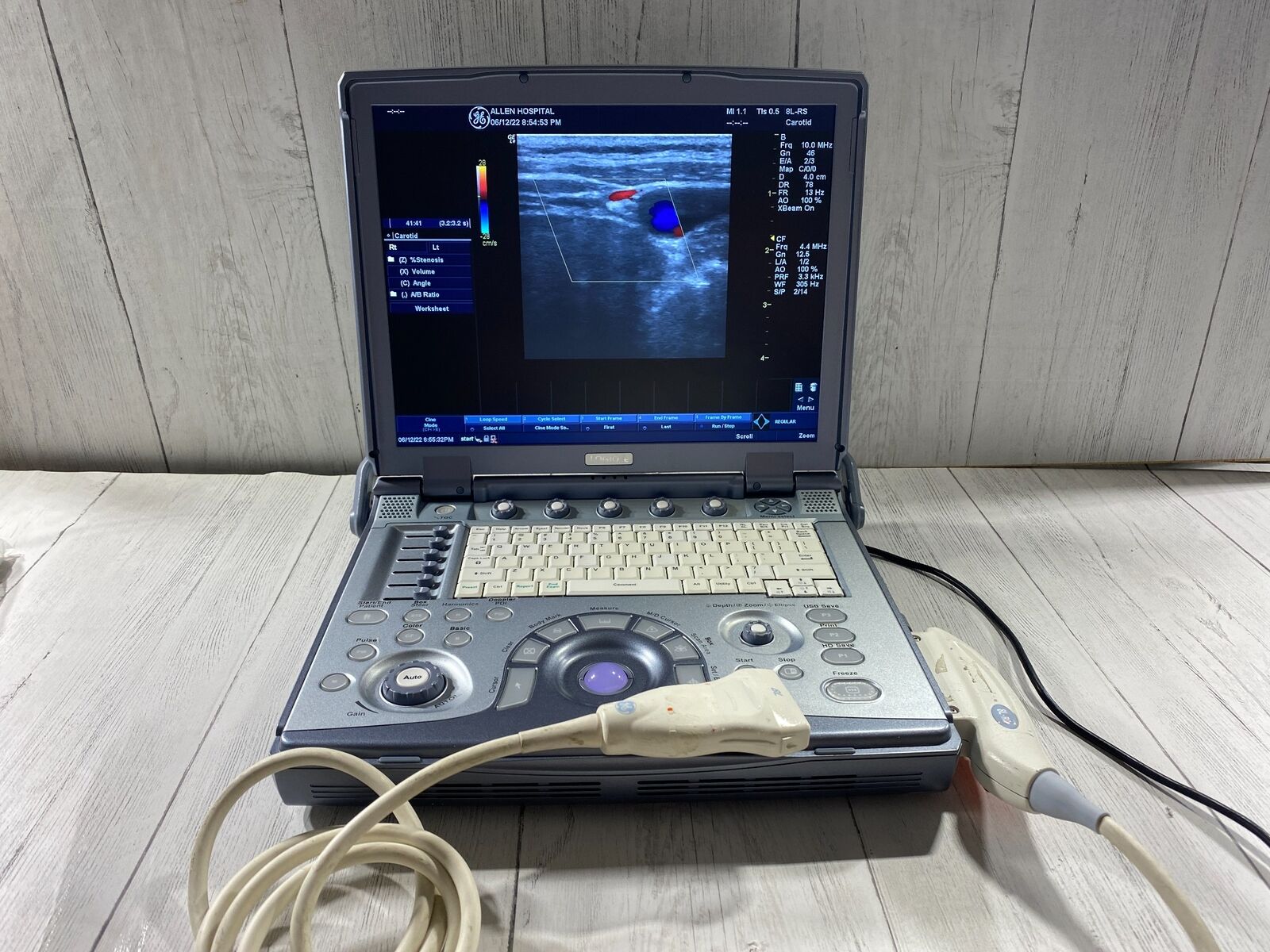 GE LogiQ E portable ultrasound DIAGNOSTIC ULTRASOUND MACHINES FOR SALE