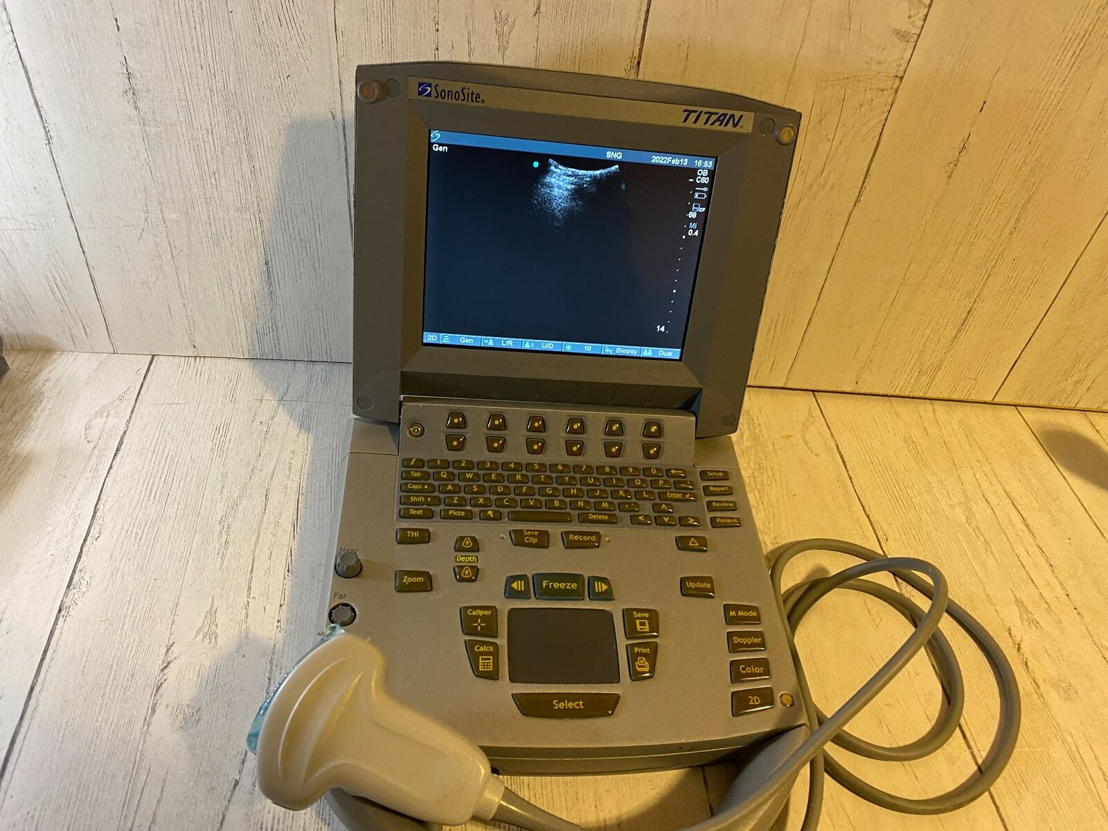 Convex C60/5-2 Mhz For Sonosite Titan Portable Ultrasound 2012 DIAGNOSTIC ULTRASOUND MACHINES FOR SALE