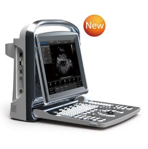 Chison ECO 1 Portable System DIAGNOSTIC ULTRASOUND MACHINES FOR SALE