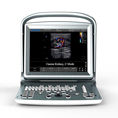 Demo Model Chison ECO 5 Portable System DIAGNOSTIC ULTRASOUND MACHINES FOR SALE