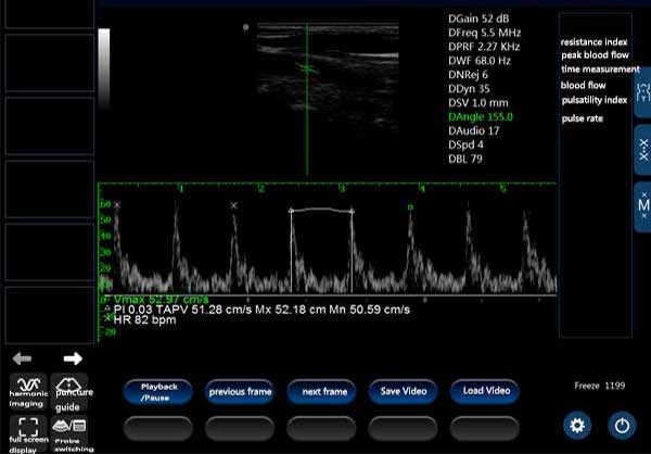 ECO-14Vet High end Equine Ultrasound with Rectal Probe DIAGNOSTIC ULTRASOUND MACHINES FOR SALE