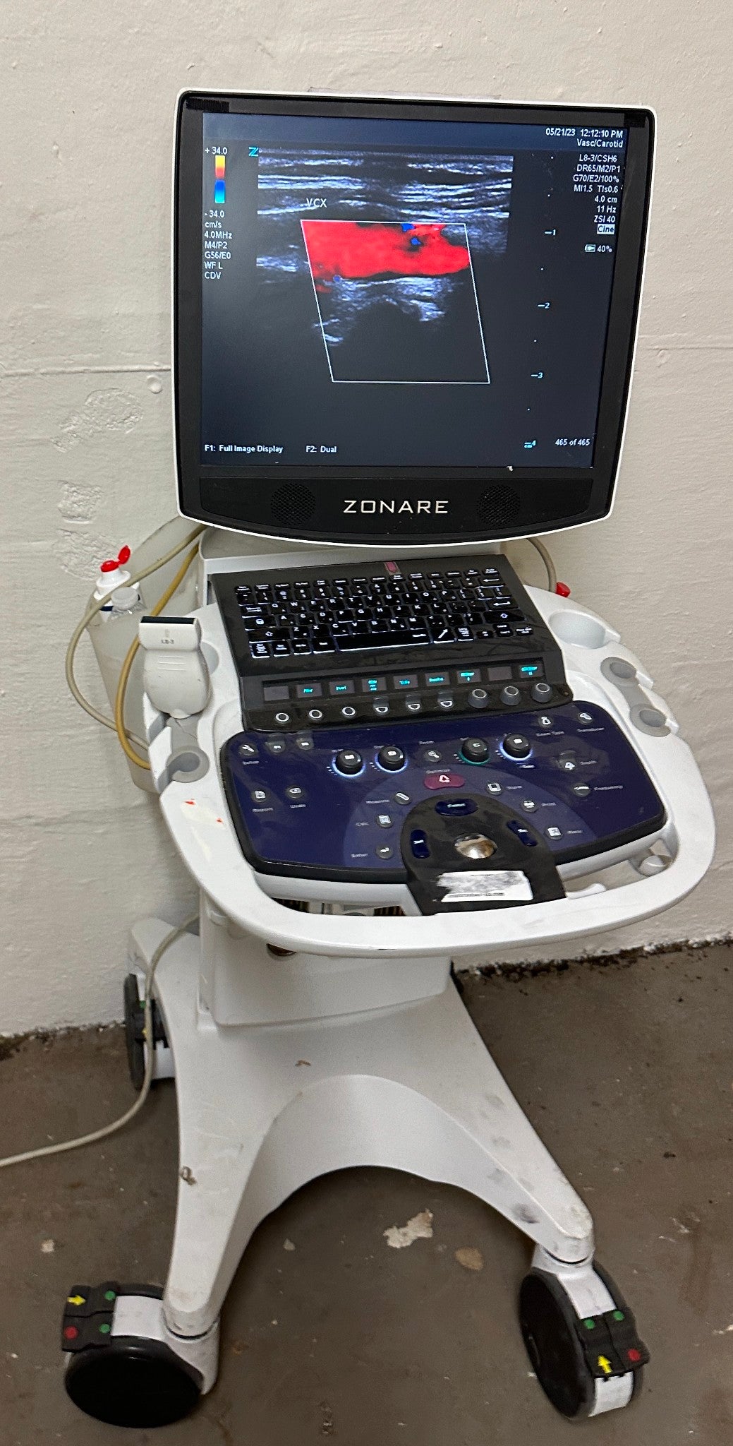 ZONARE ZS 3 Ultrasound Scanner Machine  2015 DIAGNOSTIC ULTRASOUND MACHINES FOR SALE