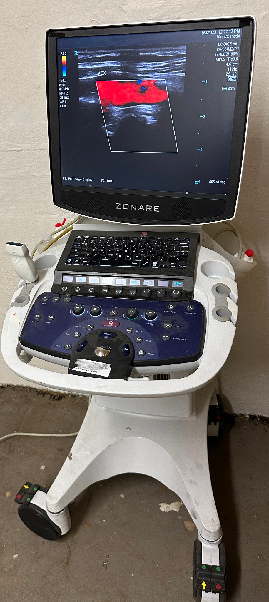 ZONARE ZS 3 Ultrasound Scanner Machine  2014 DIAGNOSTIC ULTRASOUND MACHINES FOR SALE