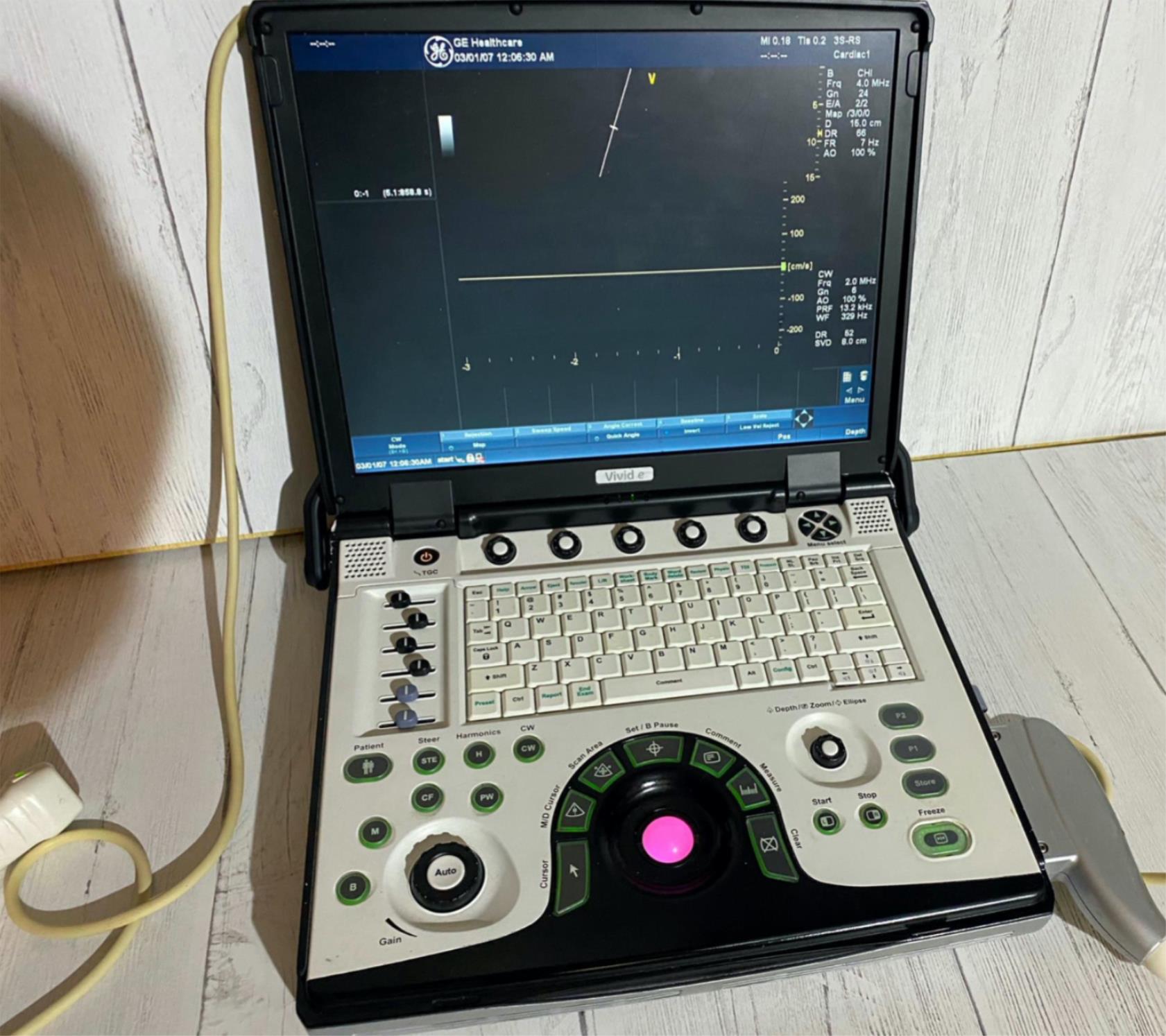 GE VIVID E Portable laptop Ultrasound with phased array probe and CW 2009 DIAGNOSTIC ULTRASOUND MACHINES FOR SALE