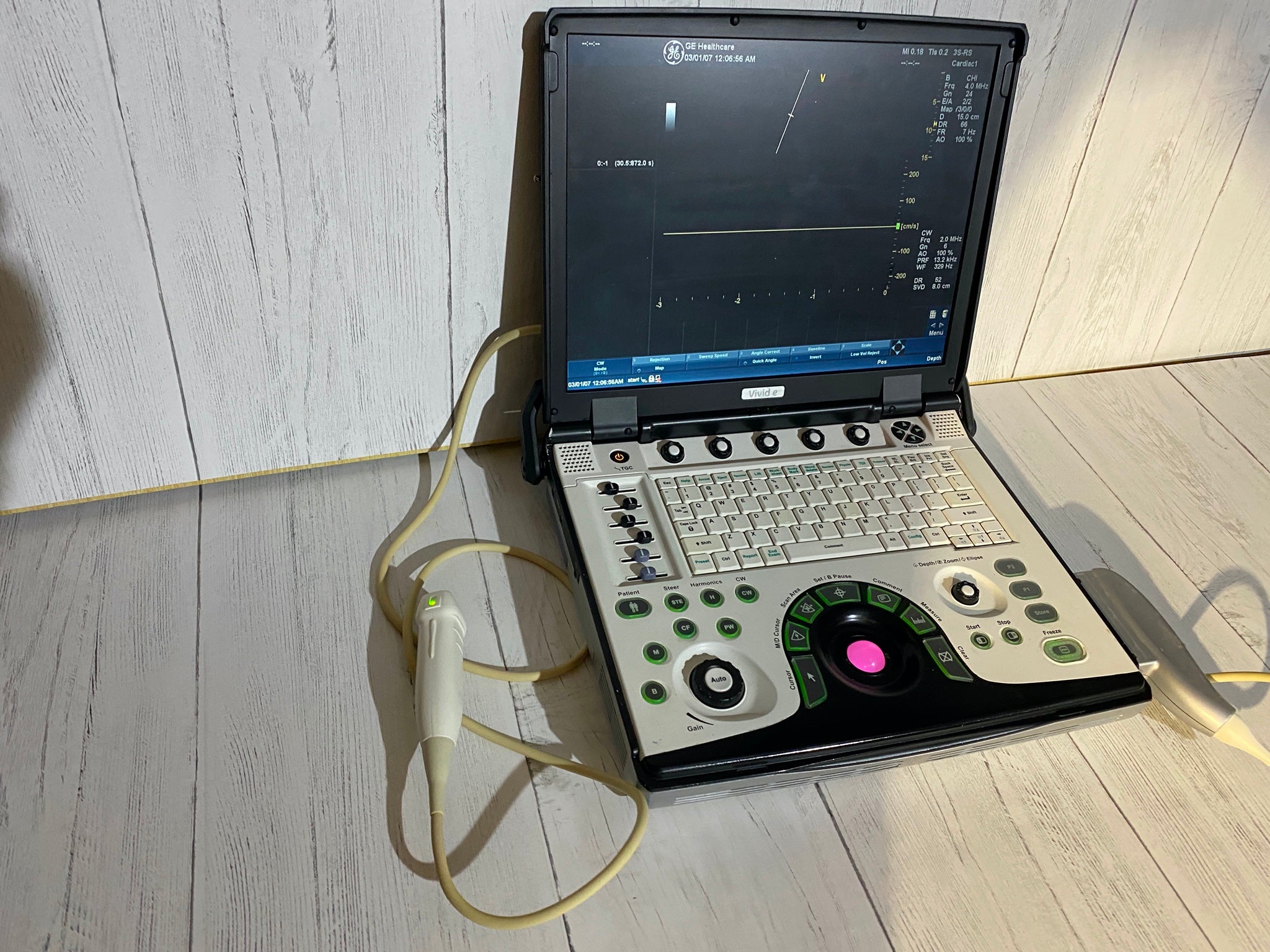 GE VIVID E Portable laptop Ultrasound with phased array probe and CW 2009 DIAGNOSTIC ULTRASOUND MACHINES FOR SALE