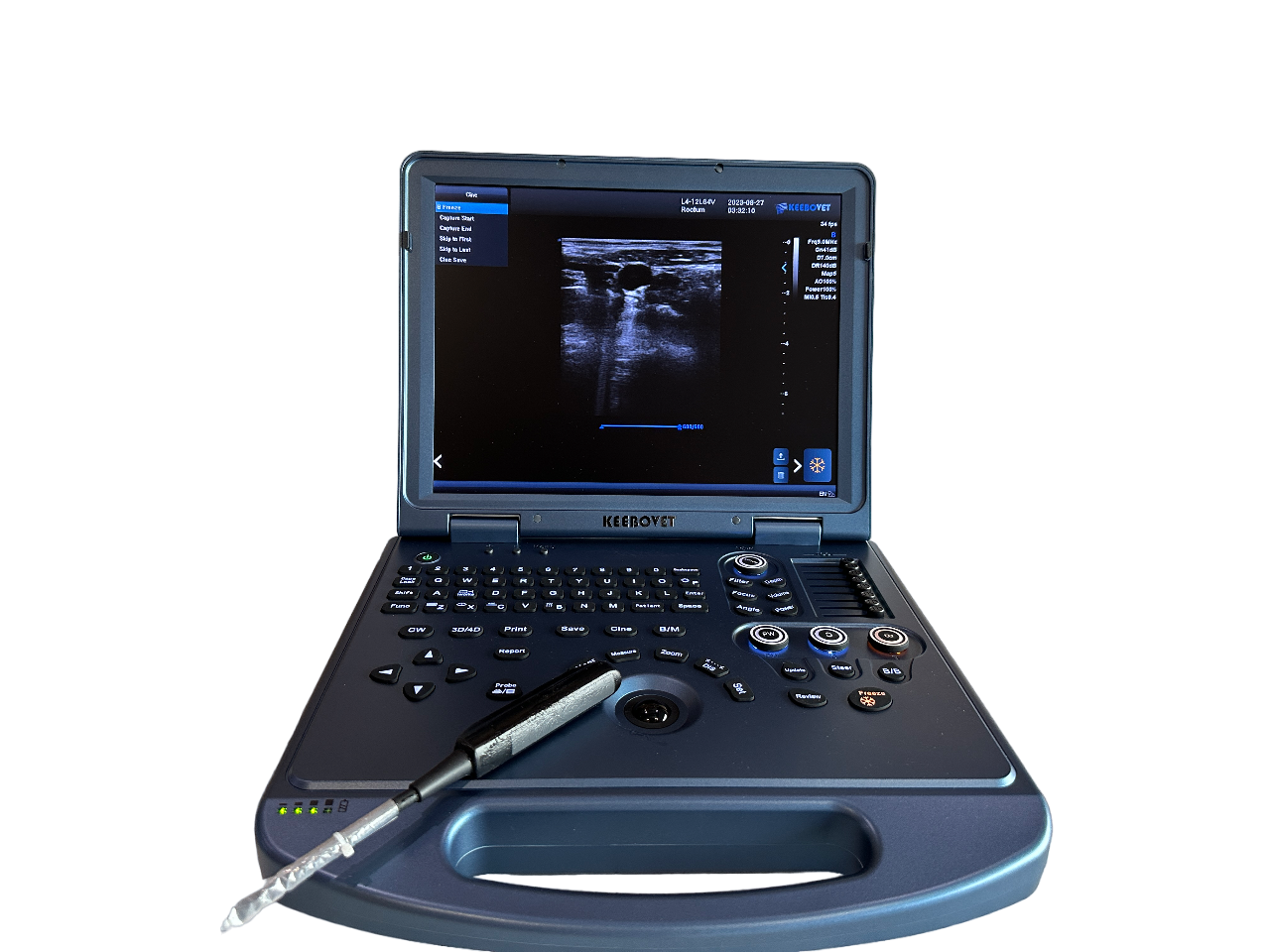 ECO-17Vet High end Equine Ultrasound with Rectal Probe  4-12 MHz Color Doppler DIAGNOSTIC ULTRASOUND MACHINES FOR SALE