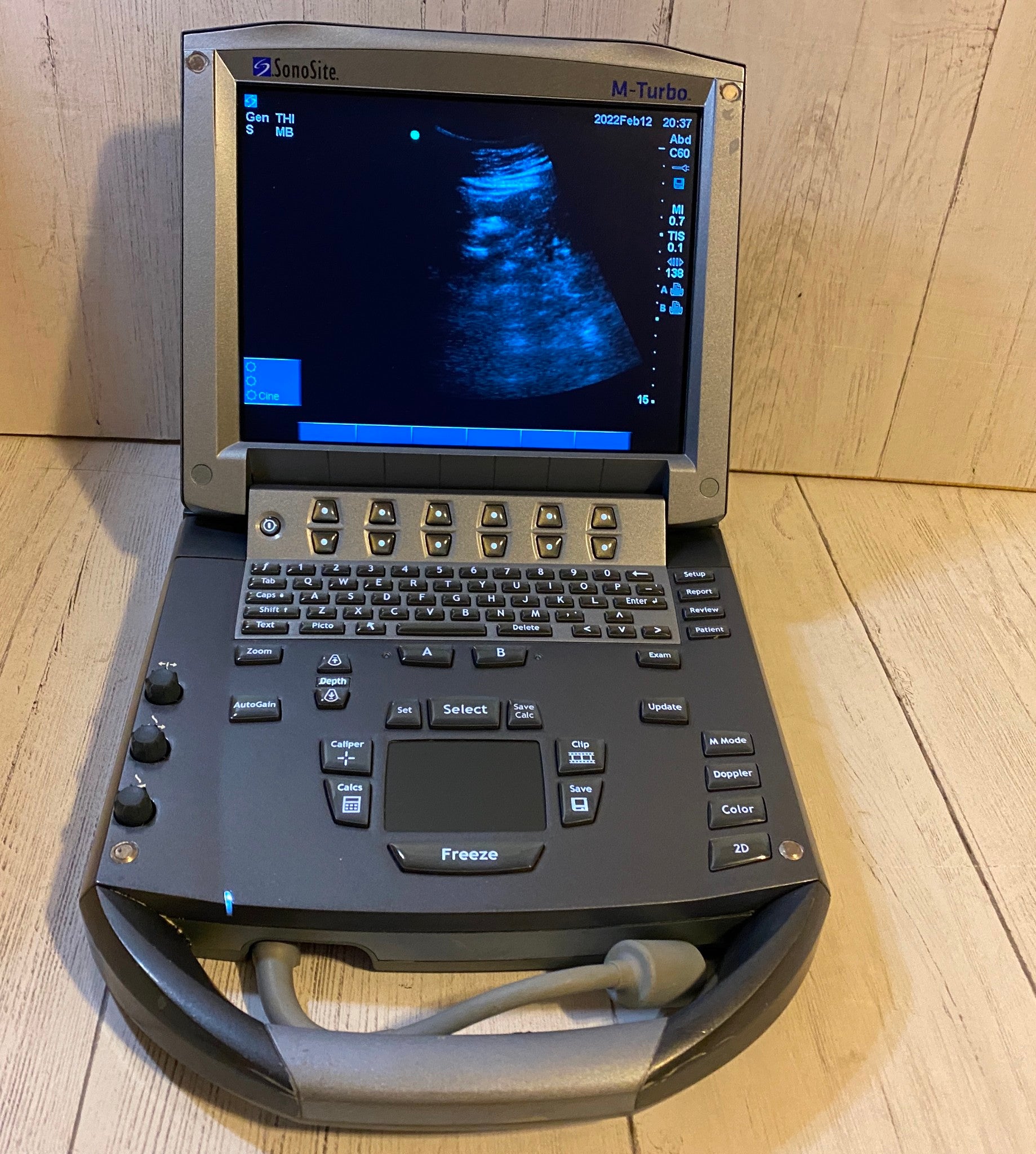 Sonosite M-Turbo Portable Ultrasound 2012 DIAGNOSTIC ULTRASOUND MACHINES FOR SALE