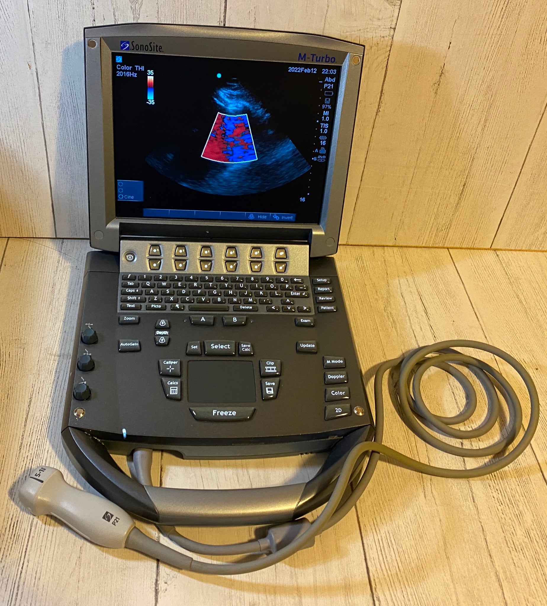 Sonosite M-Turbo Portable Ultrasound 2010 with Phased Array Probe P21 DIAGNOSTIC ULTRASOUND MACHINES FOR SALE