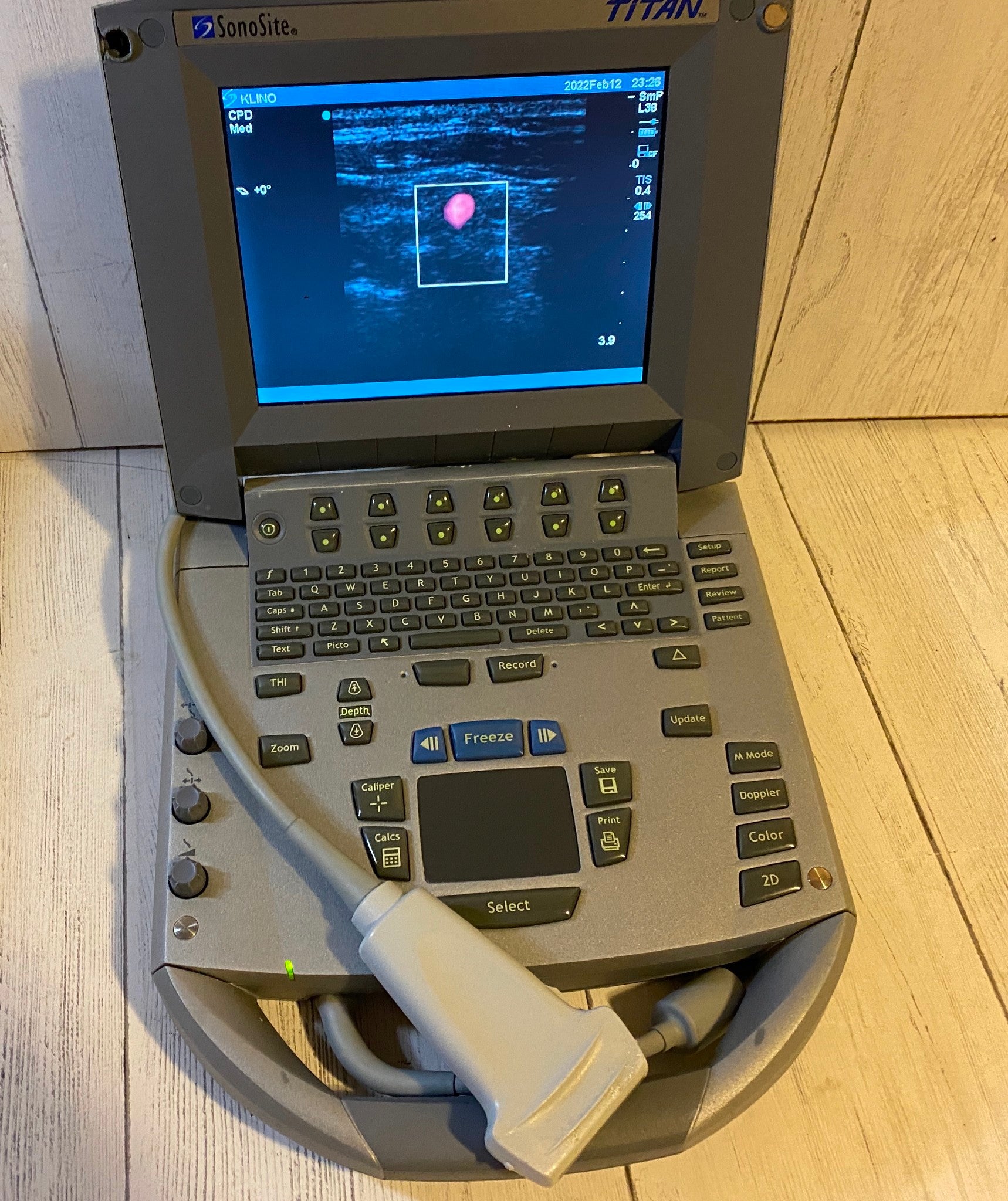 Sonosite Titan Portable Ultrasound 2011 With Linear Array probe L38 10-5Mhz DIAGNOSTIC ULTRASOUND MACHINES FOR SALE