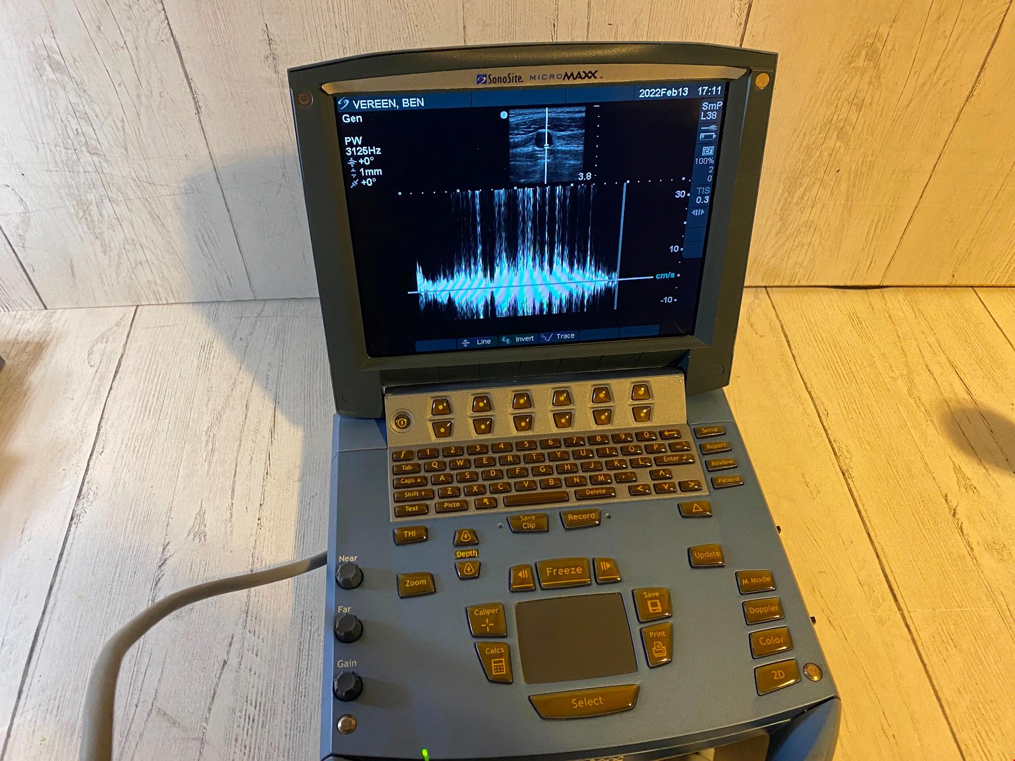 Linear Array L38e/10-5Mhz For Sonosite MicroMaxx Portable Ultrasound 2009 DIAGNOSTIC ULTRASOUND MACHINES FOR SALE