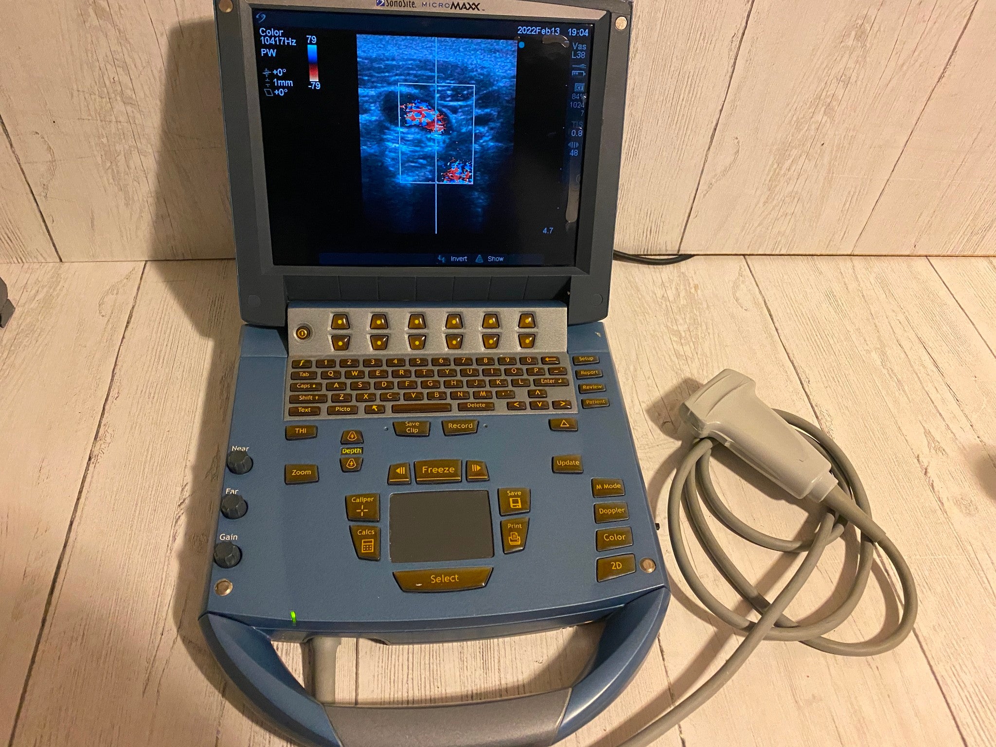 Sonosite MicroMaxx Portable Ultrasound 2005- Main unit For parts DIAGNOSTIC ULTRASOUND MACHINES FOR SALE