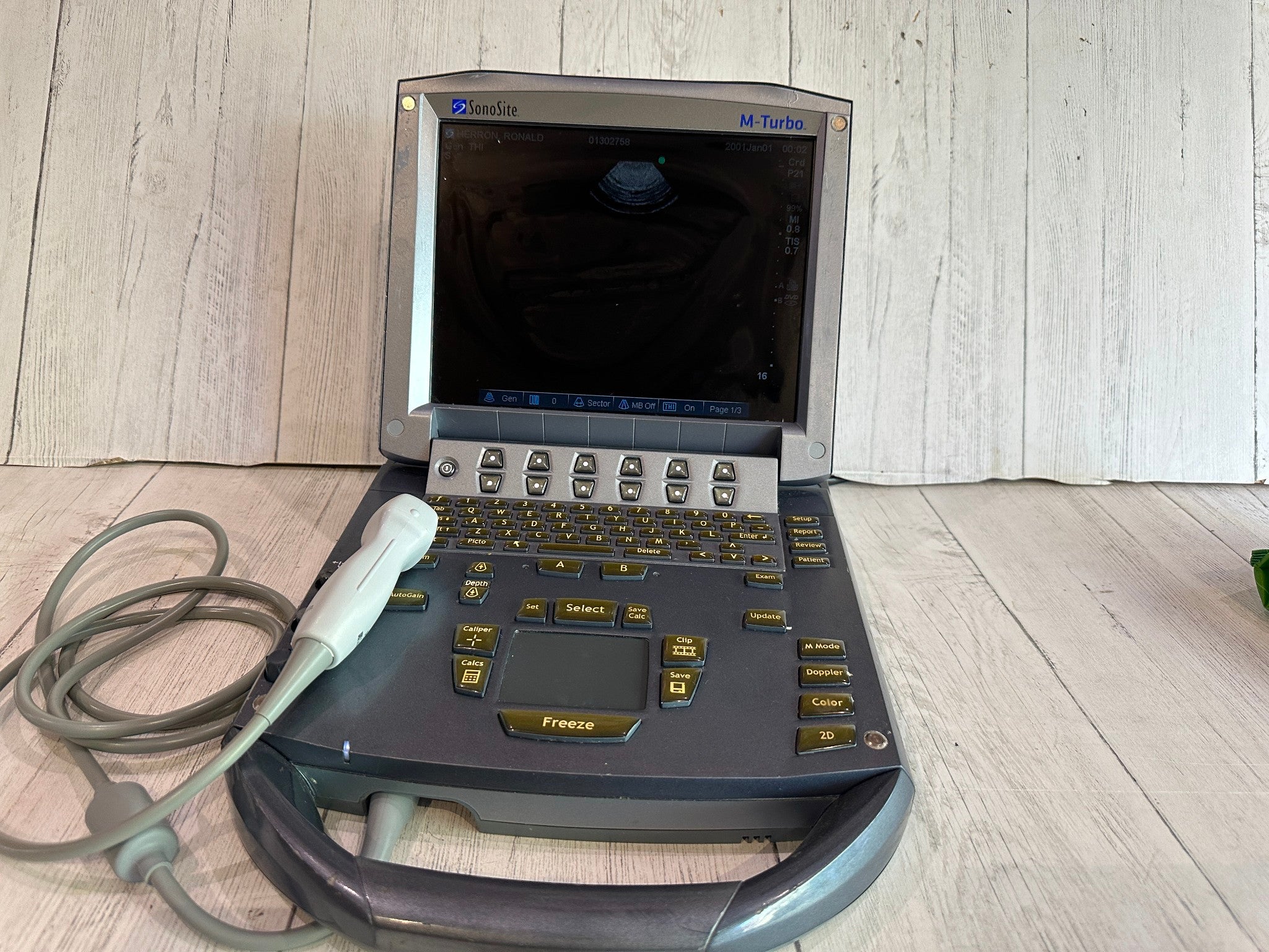 SonoSite M Turbo Ultrasound Machine 2011 With P21x Probe Warranty 6 Months DIAGNOSTIC ULTRASOUND MACHINES FOR SALE