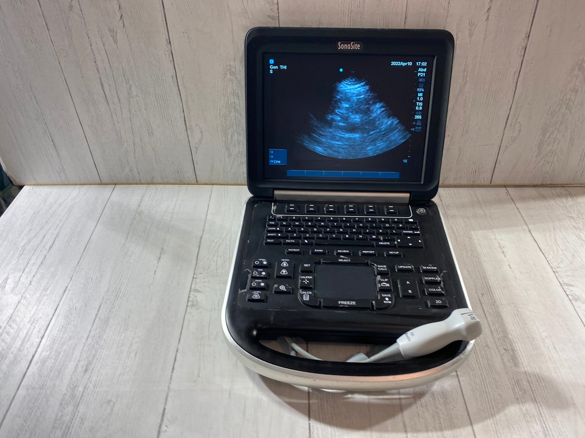 Sonosite Edge Portable ultrasound Manufactured 2013 with P21 Cardiac probe DIAGNOSTIC ULTRASOUND MACHINES FOR SALE