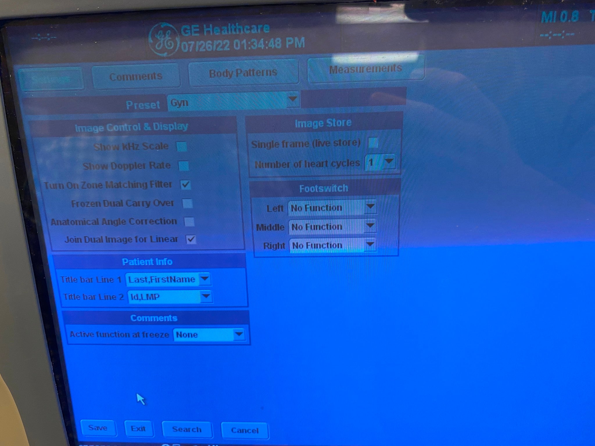 GE LOGIQ 9 ULTRASOUND MACHINE WITH 3 PROBES (M12L, E8C, 9L) 2005 DIAGNOSTIC ULTRASOUND MACHINES FOR SALE