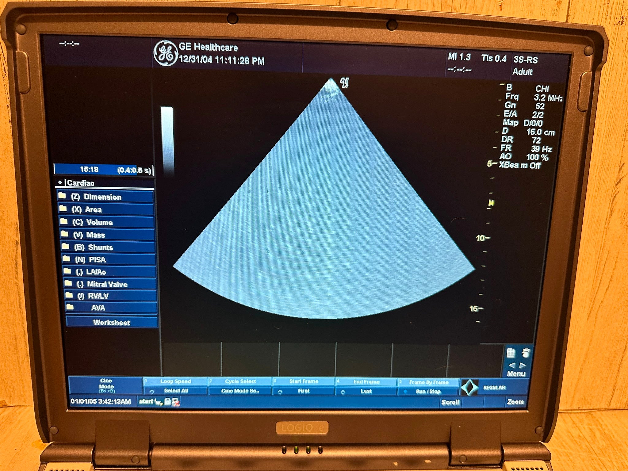 GE LOGIQ E Ultrasound 2006, Vascular, OBGYN, MSK DIAGNOSTIC ULTRASOUND MACHINES FOR SALE