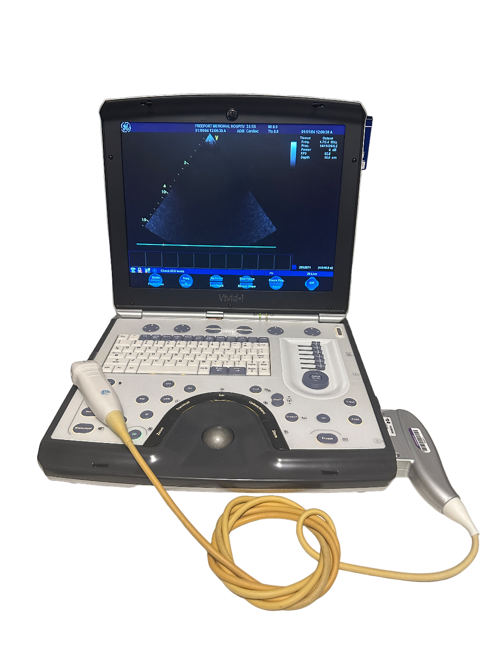 GE Vivid I Color Doppler Ultrasound & 3S-RS Phased Array Cardiac Probe 2012 DIAGNOSTIC ULTRASOUND MACHINES FOR SALE