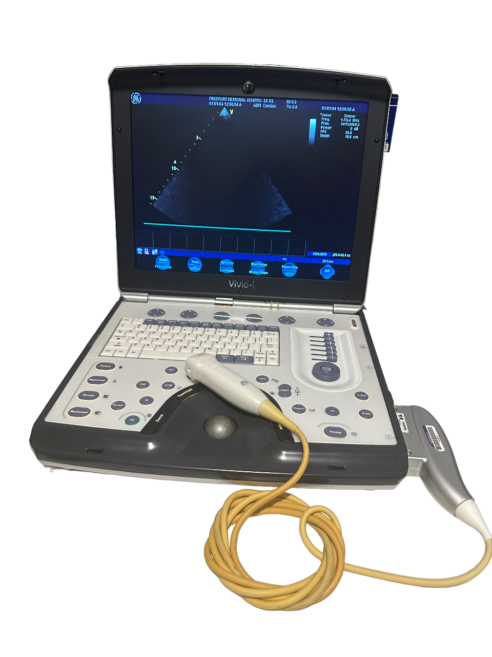 GE Vivid I Color Doppler Ultrasound & 3S-RS Phased Array Cardiac Probe 2012 DIAGNOSTIC ULTRASOUND MACHINES FOR SALE