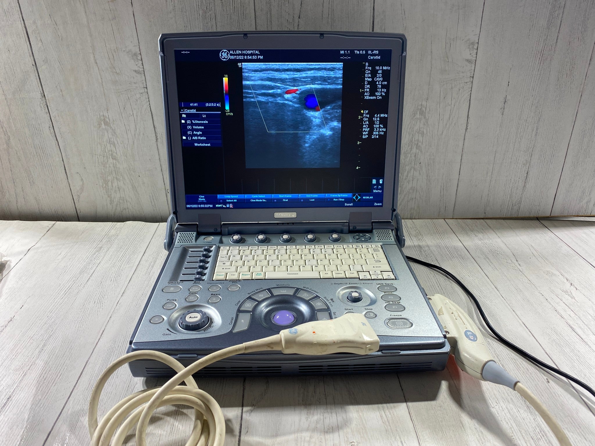 GE LogiQ E portable ultrasound with one linear array probe 8L-RS DIAGNOSTIC ULTRASOUND MACHINES FOR SALE