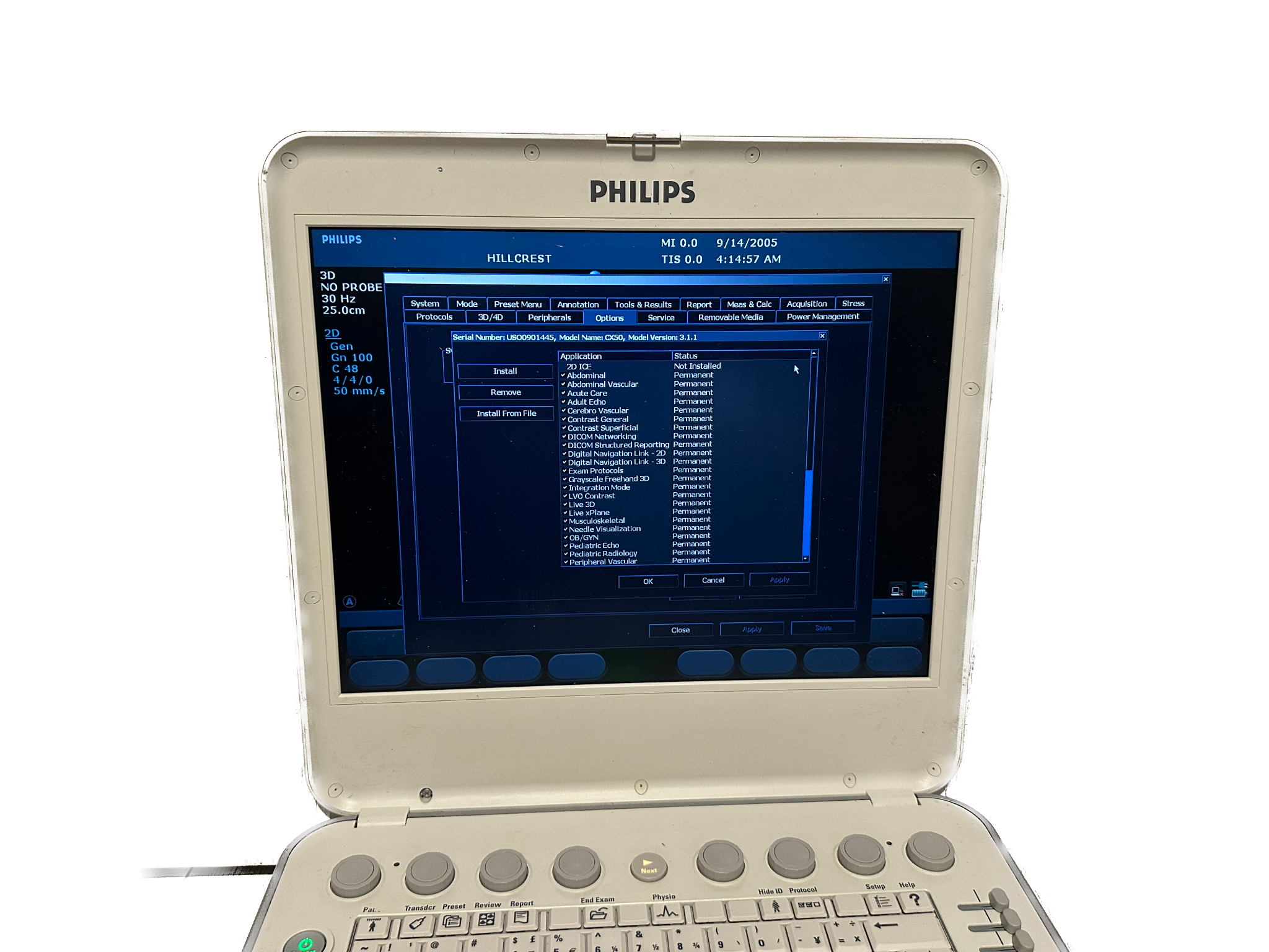 Philips CX50 2009 Ultrasound DIAGNOSTIC ULTRASOUND MACHINES FOR SALE