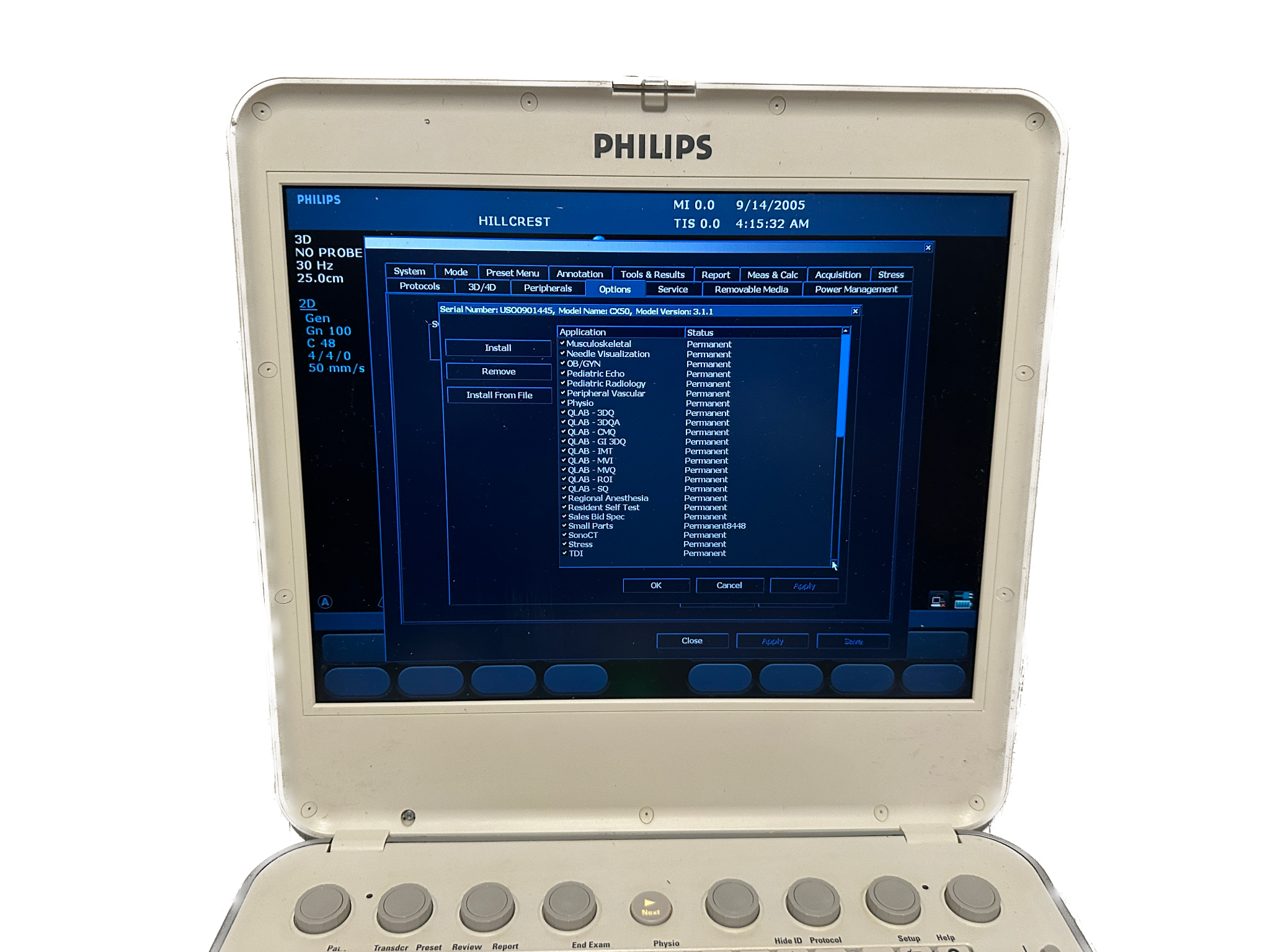 Philips CX50 2009 Ultrasound DIAGNOSTIC ULTRASOUND MACHINES FOR SALE