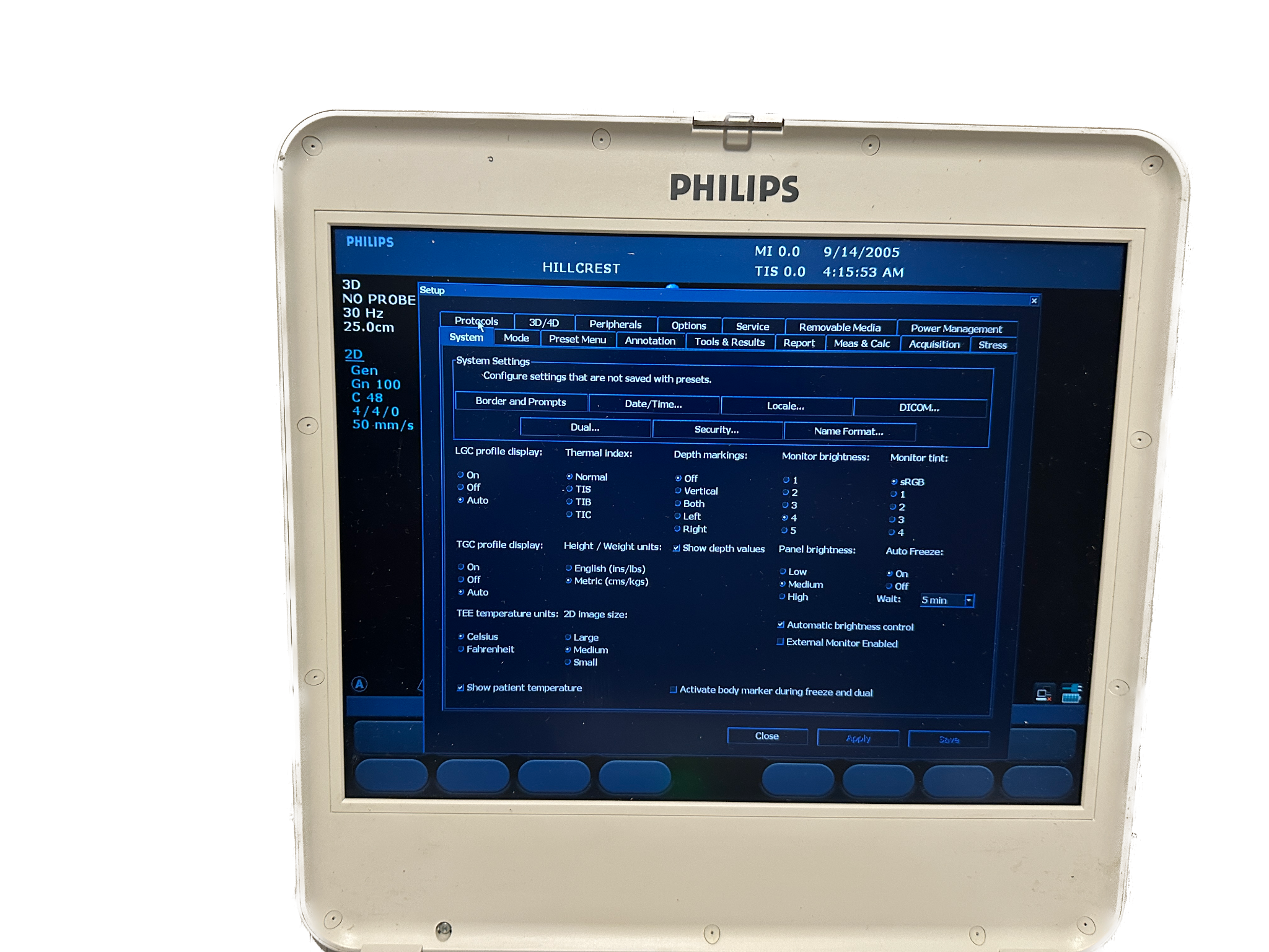 Philips CX50 2009 Ultrasound DIAGNOSTIC ULTRASOUND MACHINES FOR SALE