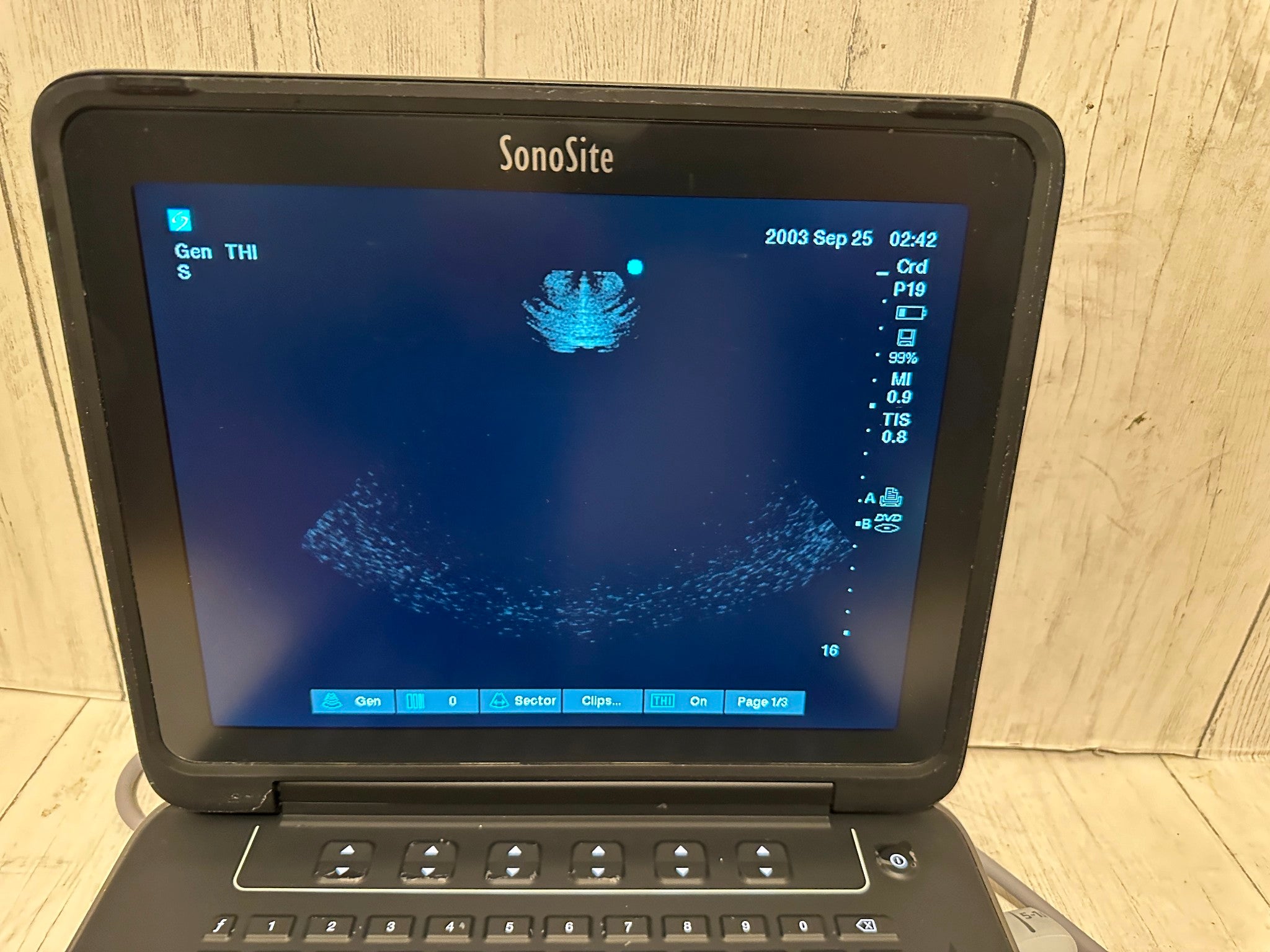 Sonosite Edge II Ultrasound 2016, DICOM  with Phased  Array probe rP19x DIAGNOSTIC ULTRASOUND MACHINES FOR SALE