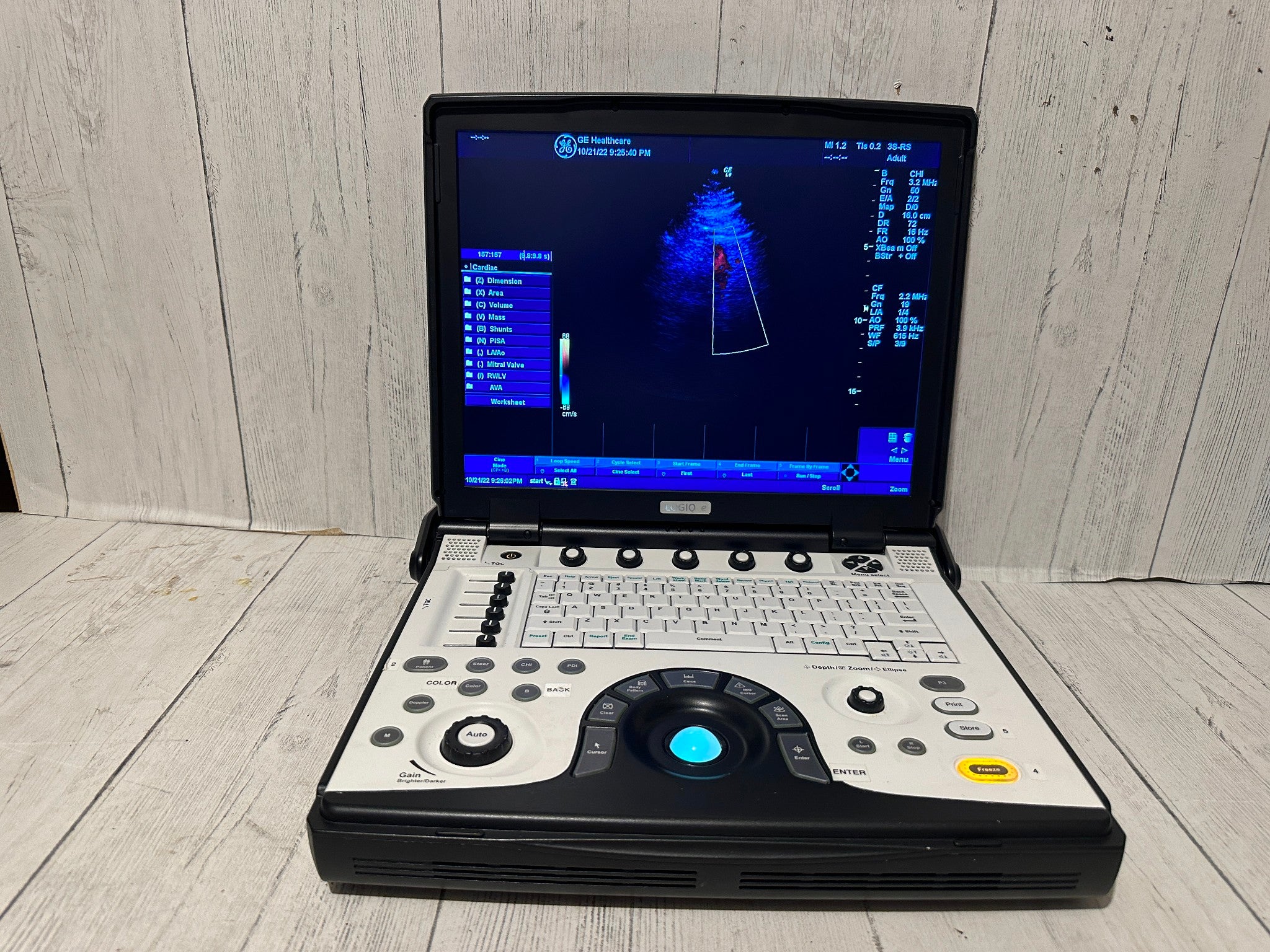 GE LOGIQ E Next Generation Ultrasound BT12  with 3S-RS Probe 2012 DIAGNOSTIC ULTRASOUND MACHINES FOR SALE