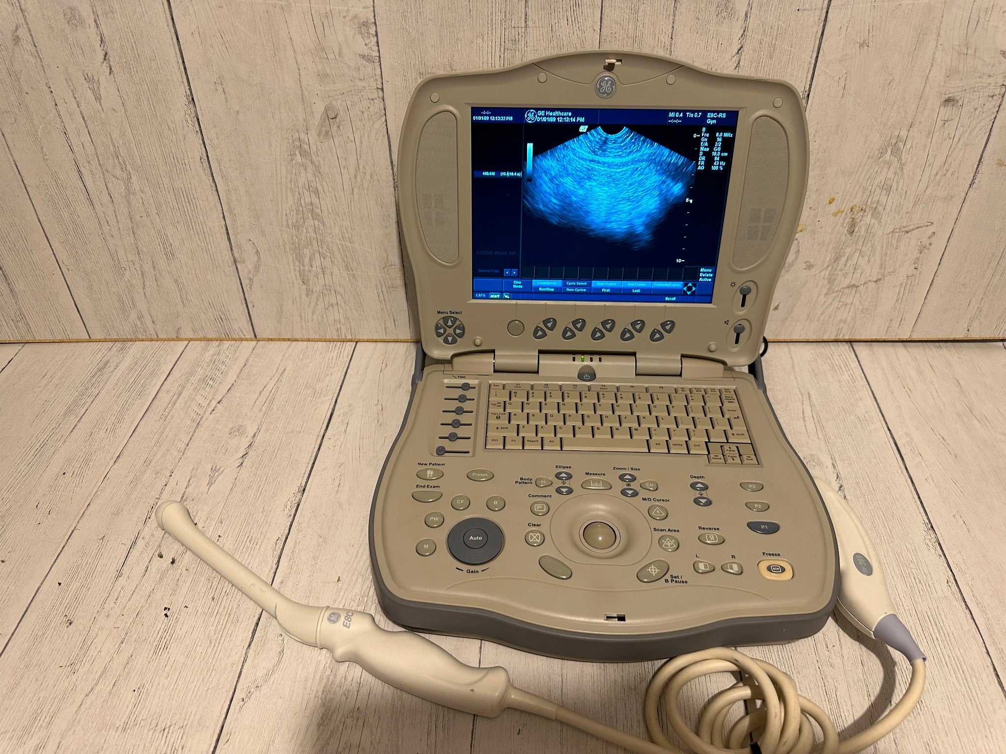 GE LOGIQ BOOK XP PORTABLE ULTRASOUND MACHINE & 3S-RS PROBE 2005 DIAGNOSTIC ULTRASOUND MACHINES FOR SALE