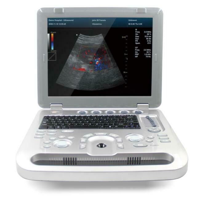 Color Doppler Ultrasound Scanner Cardiac Machine + Phased Array Probe Heart Exam DIAGNOSTIC ULTRASOUND MACHINES FOR SALE
