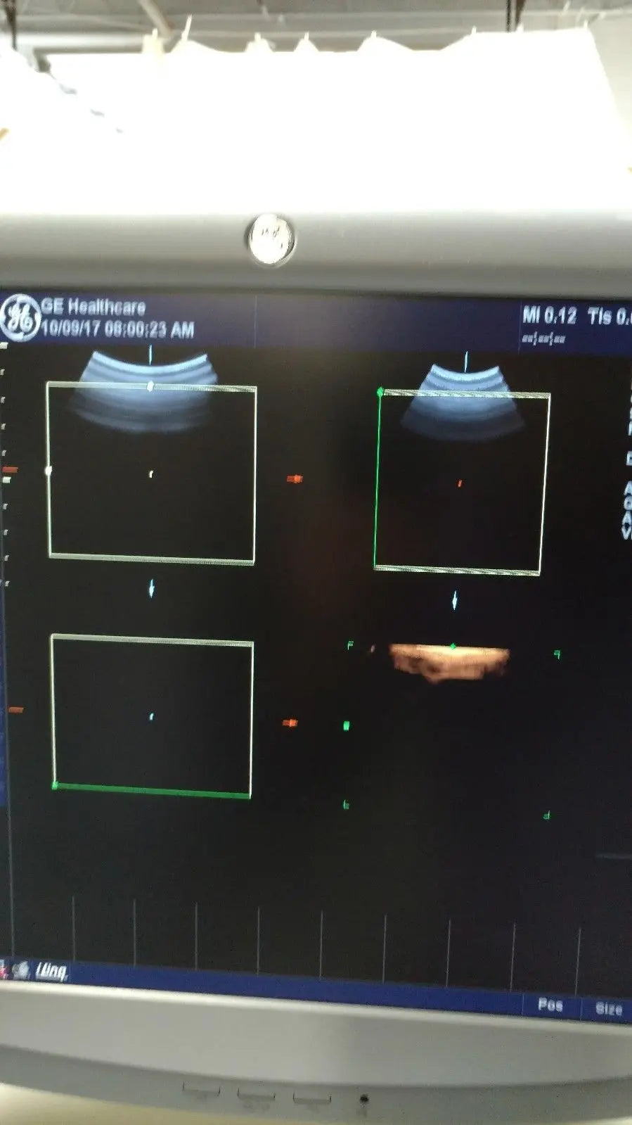 GE 4D3C-L Ultrasound Transducer DIAGNOSTIC ULTRASOUND MACHINES FOR SALE