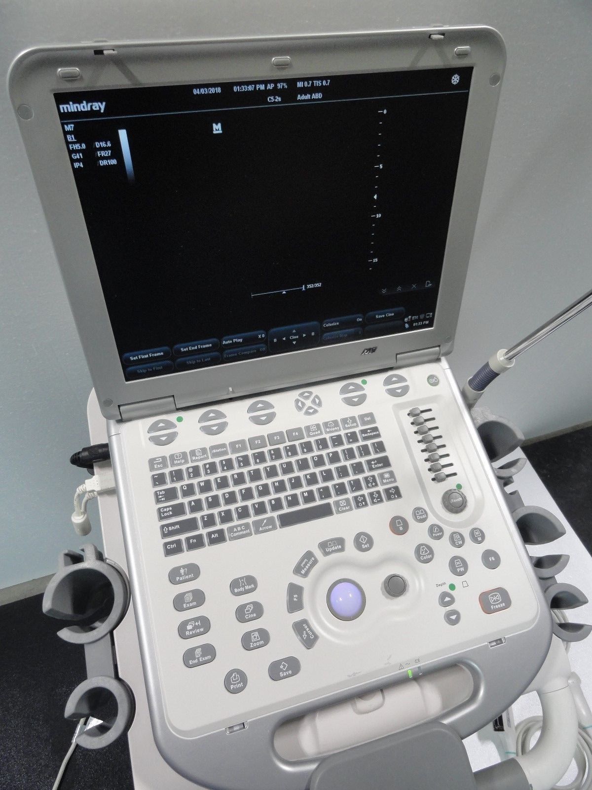 Mindray M7 Portable Ultrasound Loaded unit with 3 probes transducers no sonosite DIAGNOSTIC ULTRASOUND MACHINES FOR SALE