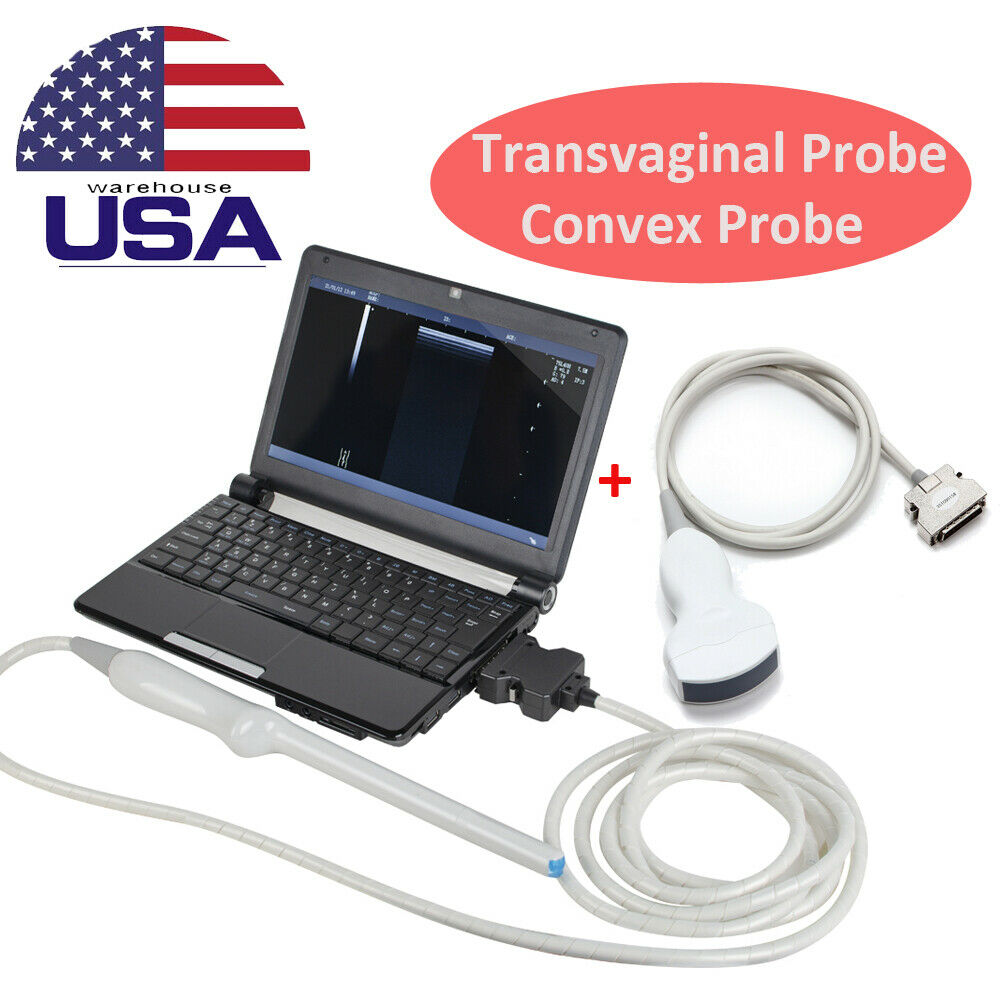 10" Portable Digital Laptop Ultrasound Scanner System Convex Transvaginal Probes DIAGNOSTIC ULTRASOUND MACHINES FOR SALE