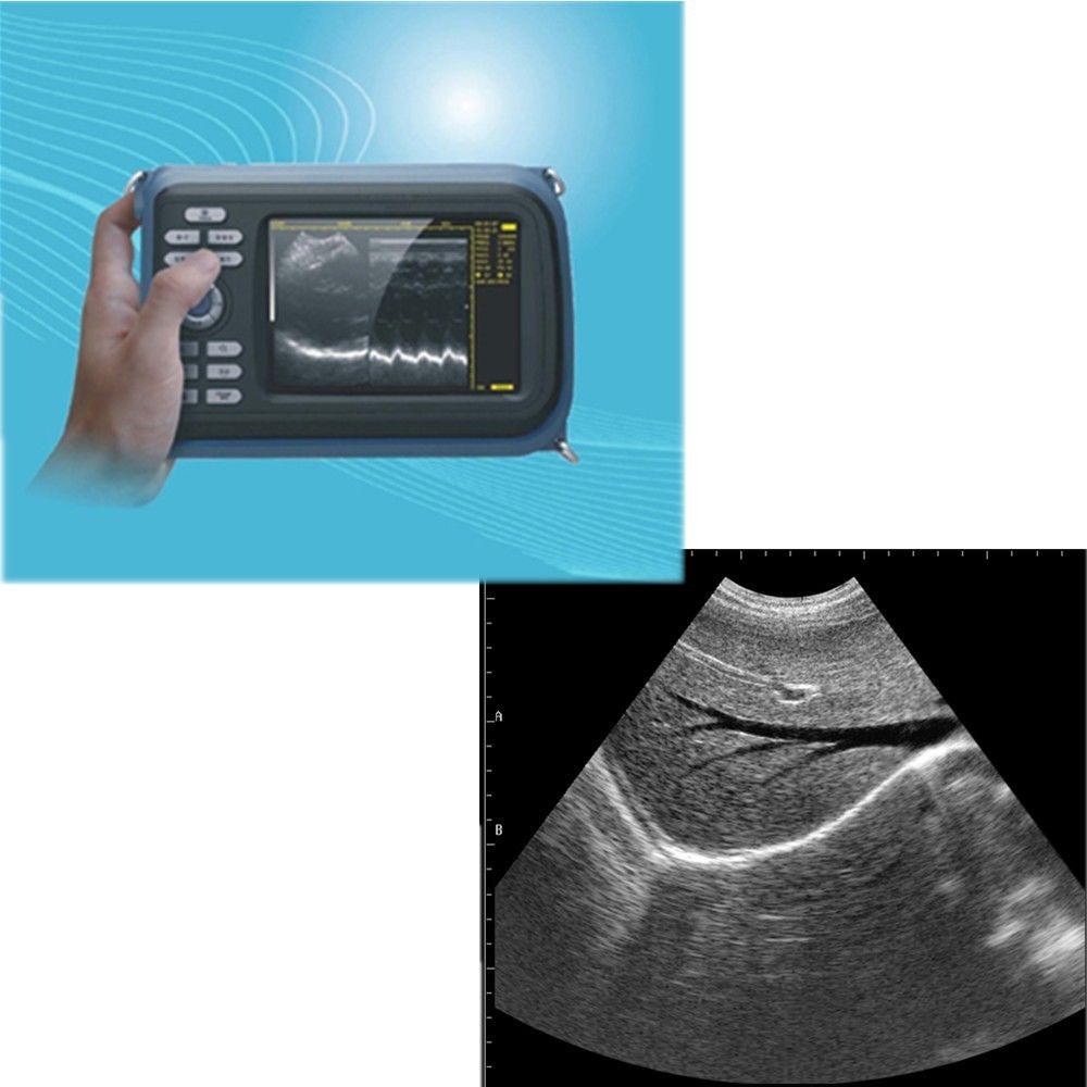 Human Laptop Machine Ultrasound Scanner System Convex + Transvaginal Probe+ Case DIAGNOSTIC ULTRASOUND MACHINES FOR SALE