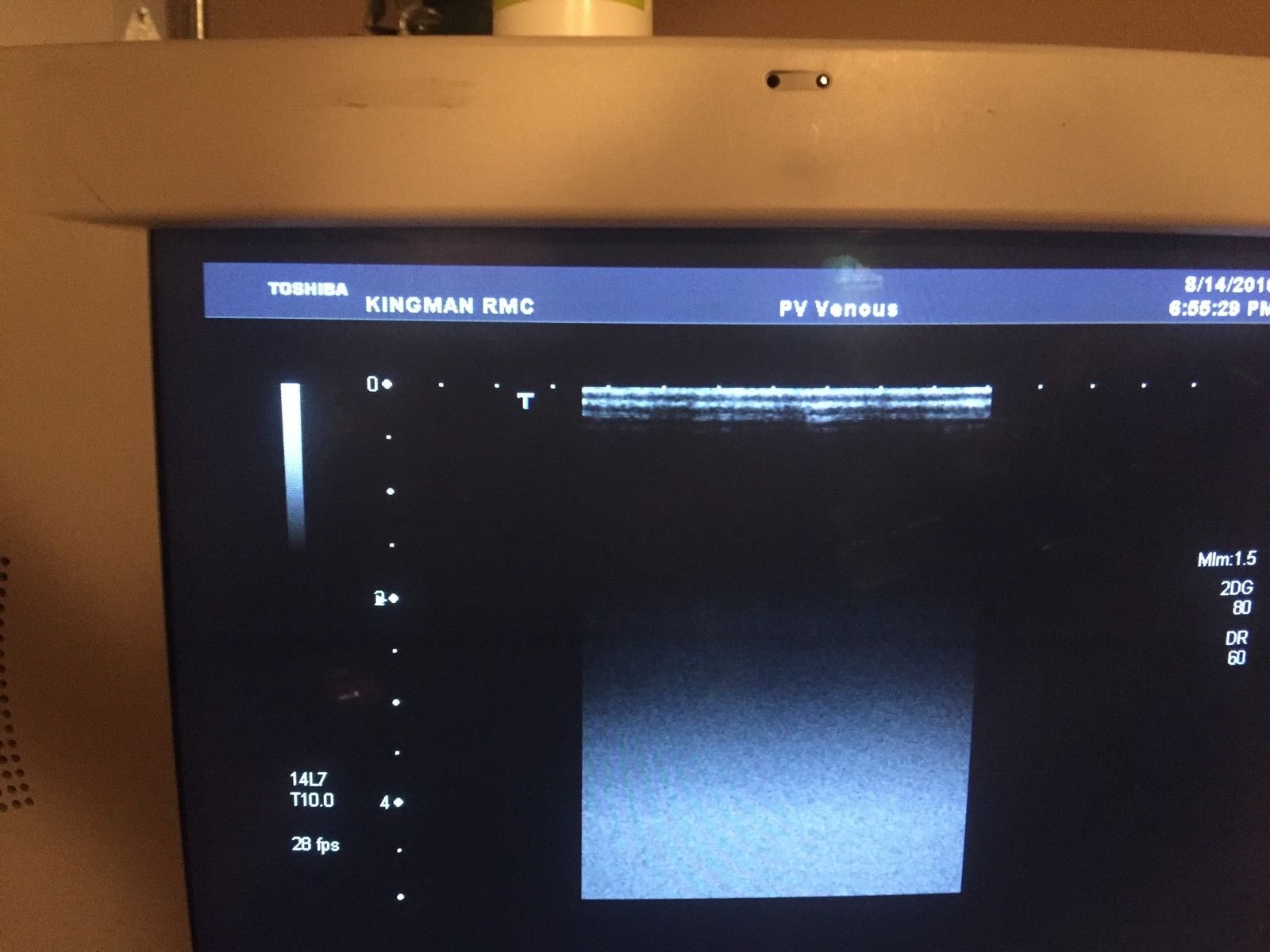 Toshiba Ultrasound transducer probe Linear PLT-1204at DIAGNOSTIC ULTRASOUND MACHINES FOR SALE