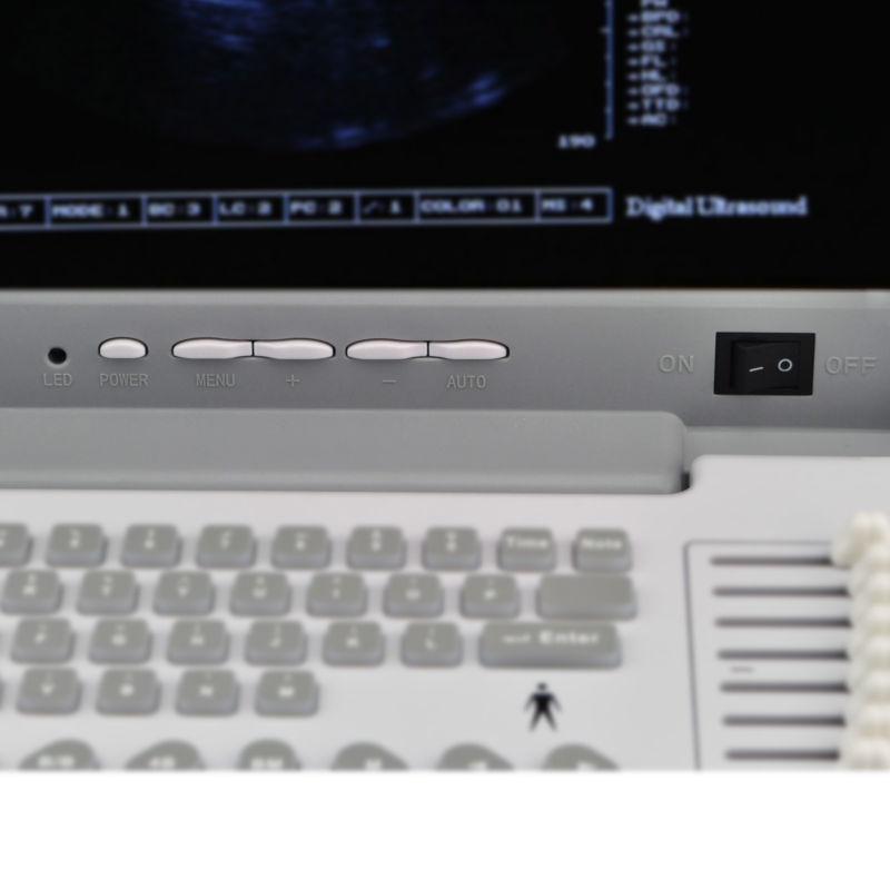 Medical Digital Ultrasound Scanner Machine 6.5Mhz Transvaginal Probe 3D CE Sale 190891224682 DIAGNOSTIC ULTRASOUND MACHINES FOR SALE