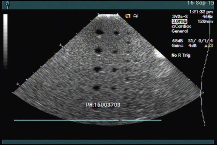 Siemens ACUSON 3V2c Ultrasound Transducer DIAGNOSTIC ULTRASOUND MACHINES FOR SALE