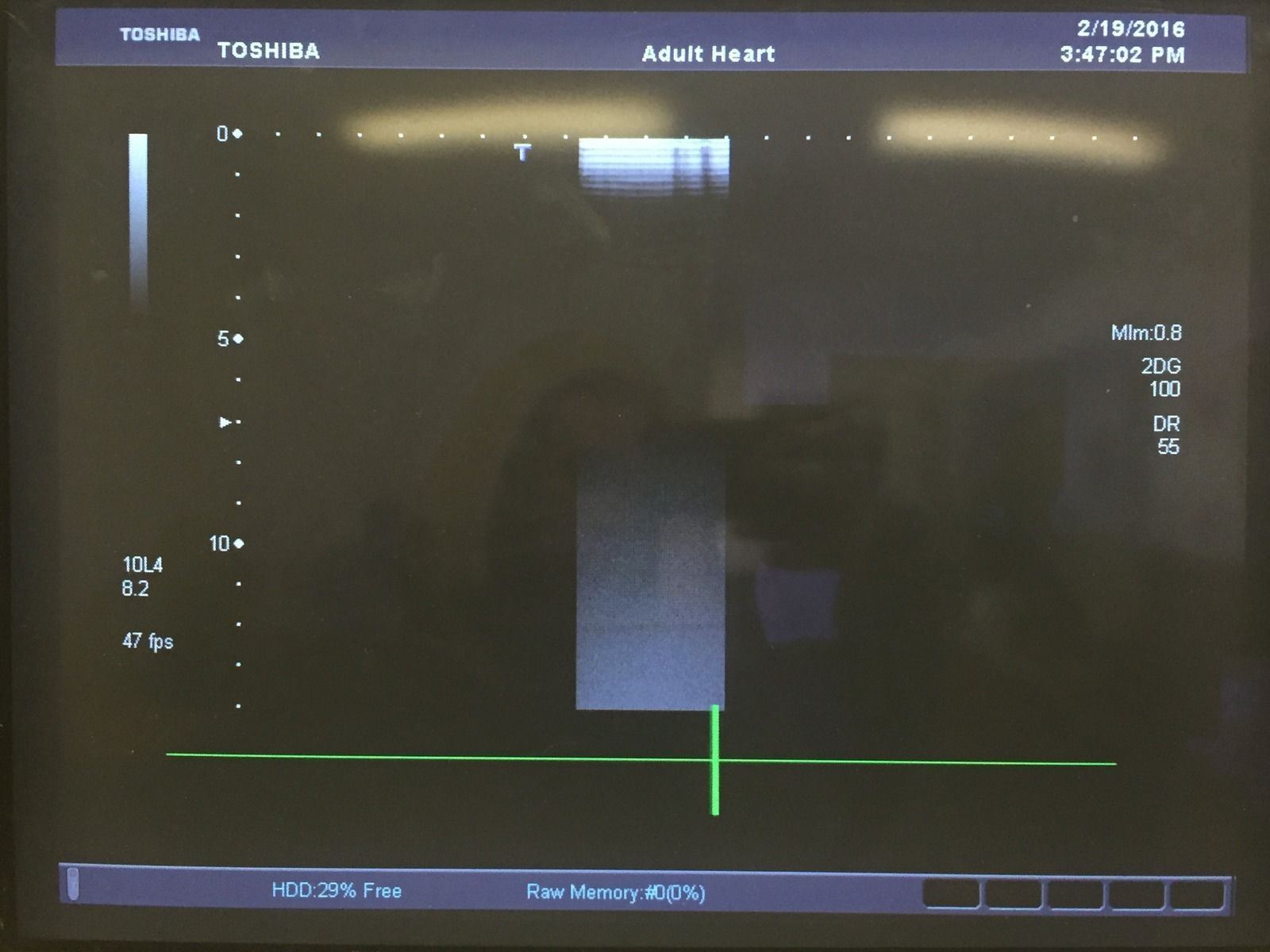 Toshiba Aplio PLT-604AT 6.0MHz Linear Ultrasound Transducer Medical Equipment DIAGNOSTIC ULTRASOUND MACHINES FOR SALE