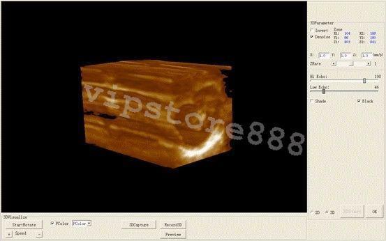 Digital Ultrasound Scanner Machine  +Convex +Vaginal + Linear 3 Probes/Sensor+3D DIAGNOSTIC ULTRASOUND MACHINES FOR SALE