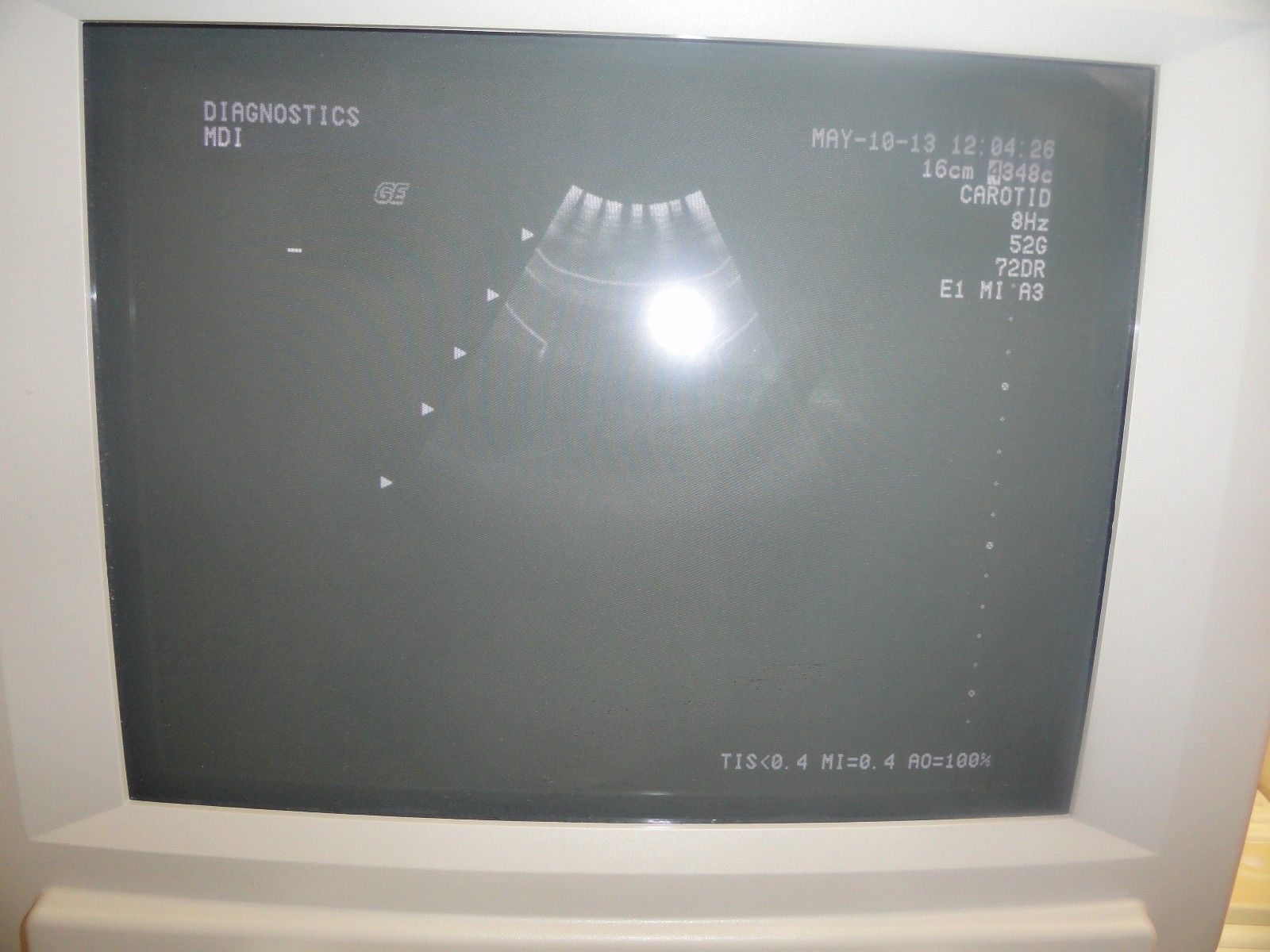 GE 348c P/N 2197480 Convex Array Probe for GE 700, 700 PRO and 700 Expert (5514) DIAGNOSTIC ULTRASOUND MACHINES FOR SALE