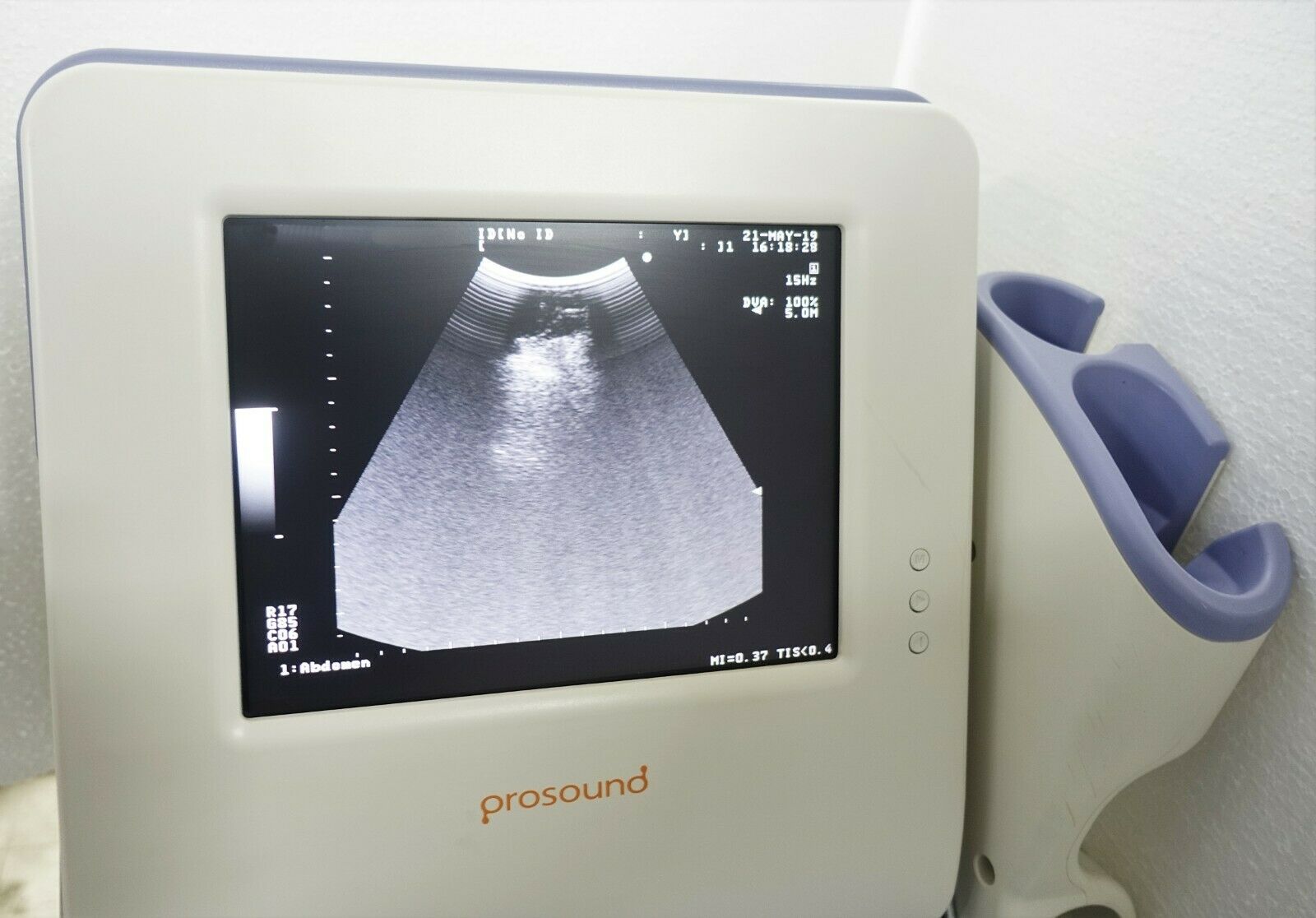 HITACHI ALOKA PROSOUND 2 DIAGNOSTIC ULTRASOUND P2 PORTABLE w UST-934N-3.5 PROBE DIAGNOSTIC ULTRASOUND MACHINES FOR SALE