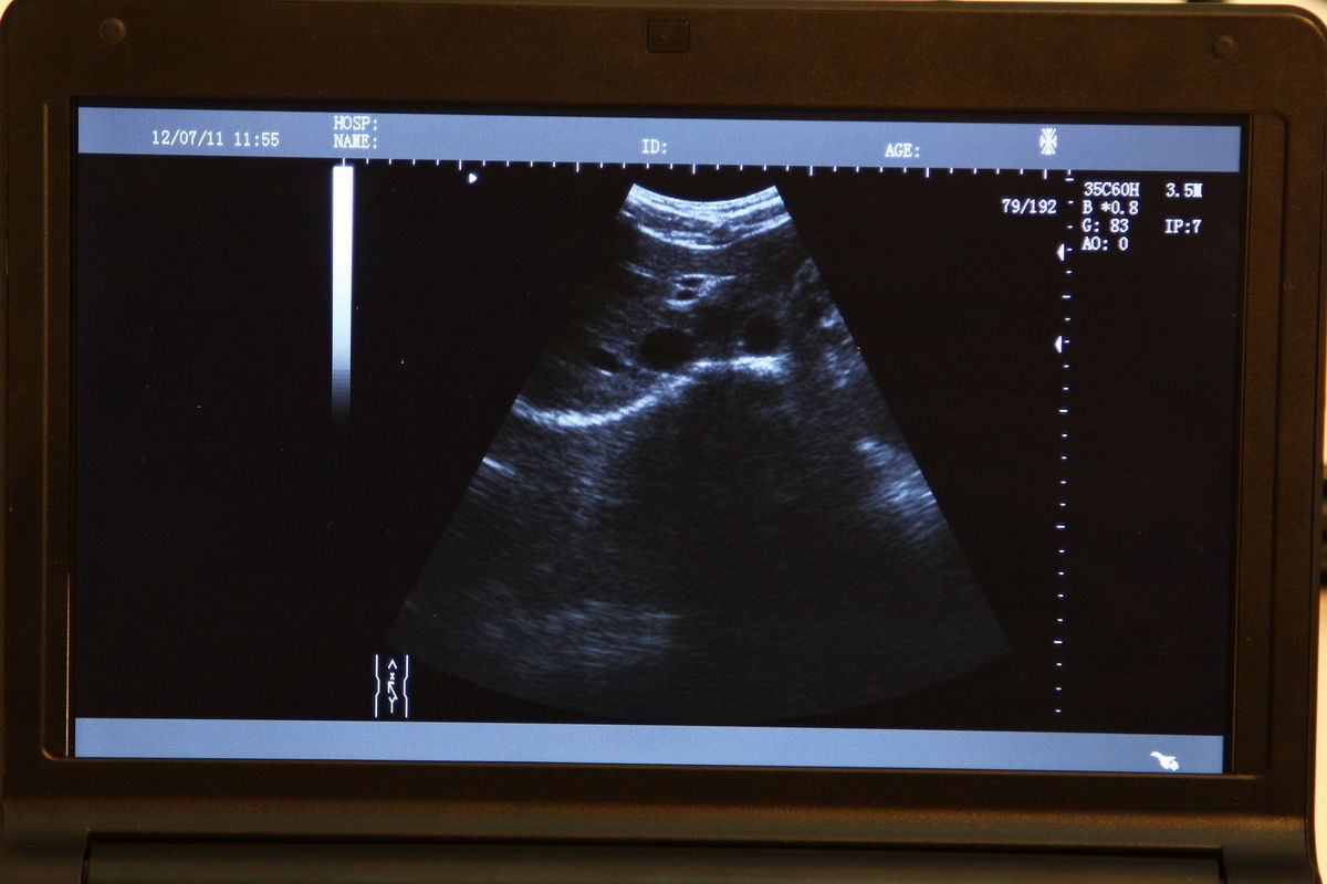 veterinary Laptop Vet Ultrasound Scanner Machine  Animal Rectal probe 3D Sale 190891379269 DIAGNOSTIC ULTRASOUND MACHINES FOR SALE