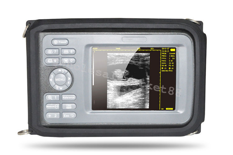 HandScan Full Digital Ultrasound scanner Machine Convex+ Transvaginal probe Case DIAGNOSTIC ULTRASOUND MACHINES FOR SALE