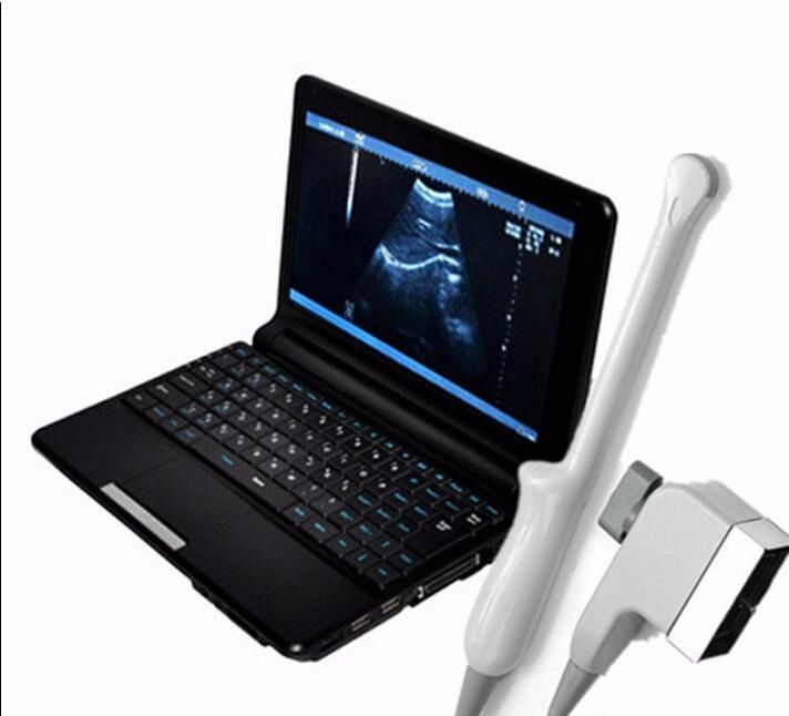 Laptop Digital  Ultrasound scanner with Transvaginal probe,+3D With Box CE A+ 190891499356 DIAGNOSTIC ULTRASOUND MACHINES FOR SALE